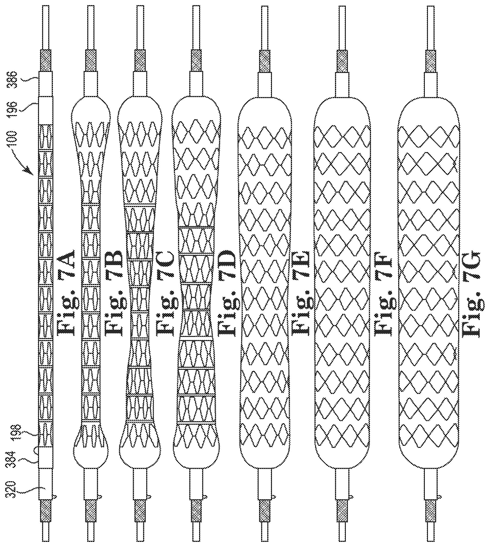Patent US11779481 Figure 8 – Controlled endoprosthesis balloon expansion
