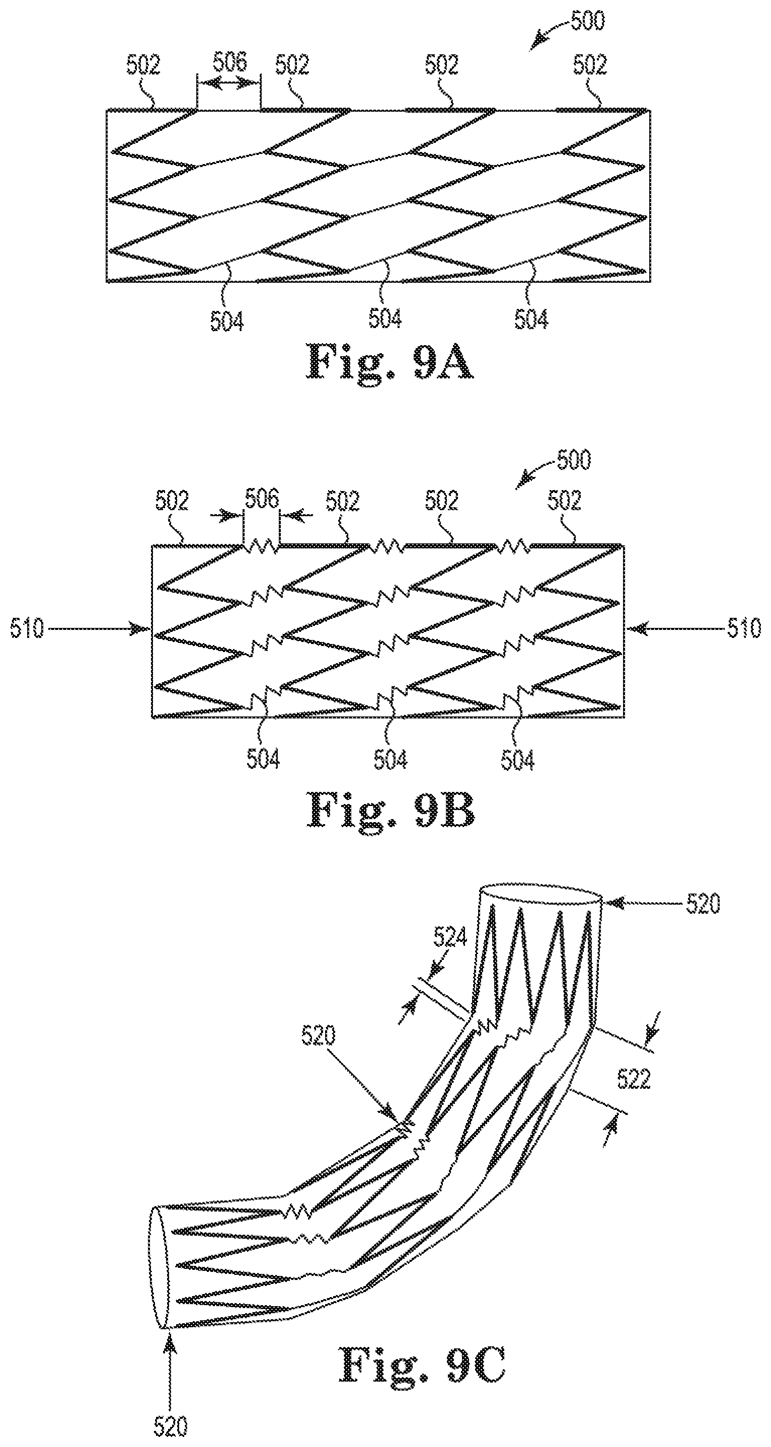 Patent US11779481 Figure 10 – Controlled endoprosthesis balloon expansion