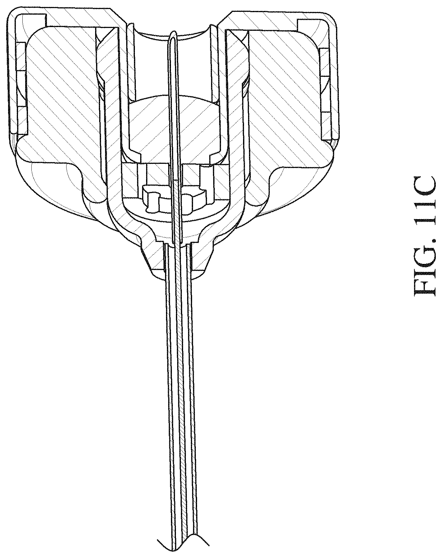 Patent US11779482 Figure 19 – Intragastric device