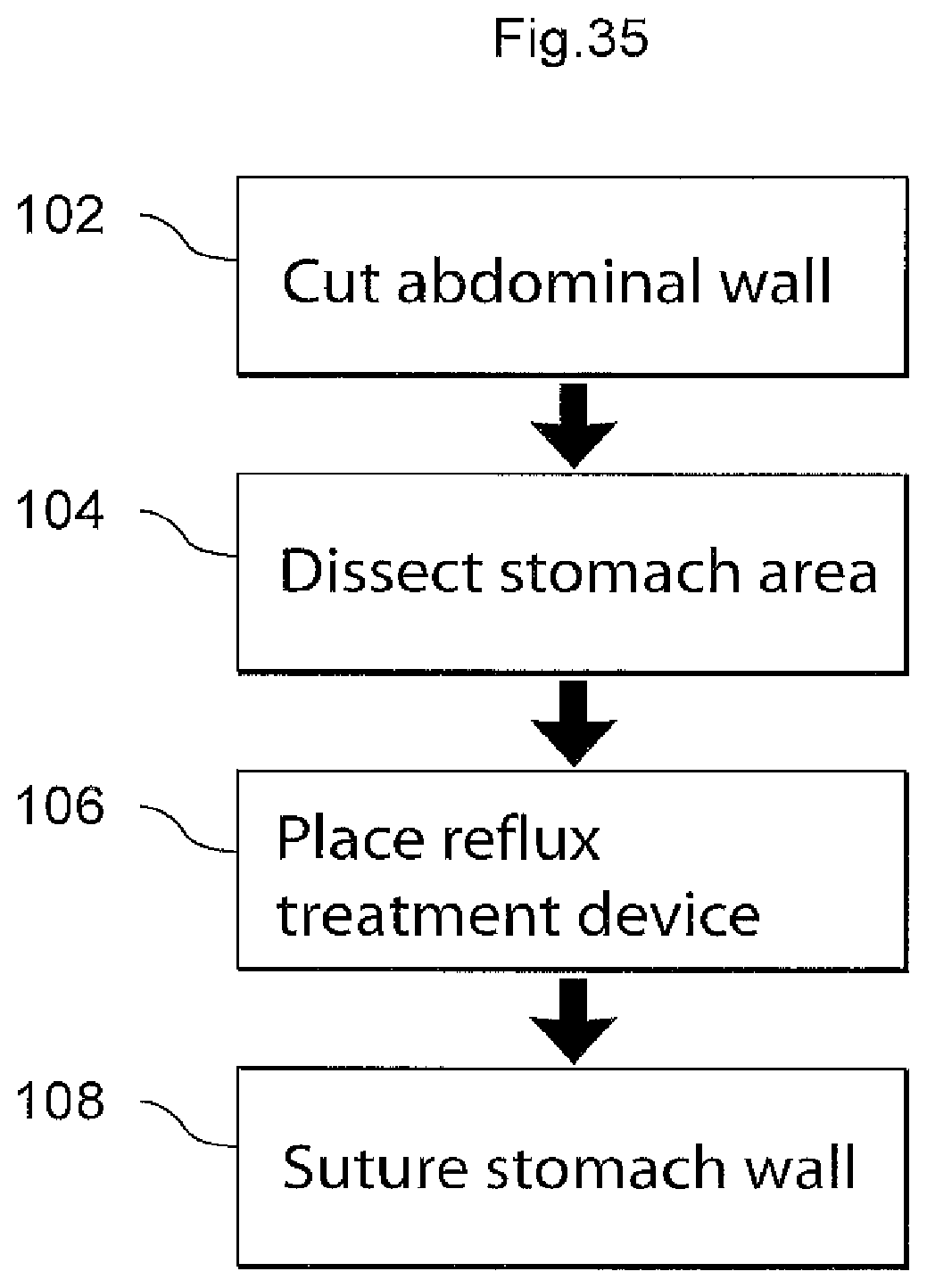 Patent US11779483 Figure 17 – Apparatus for treating GERD