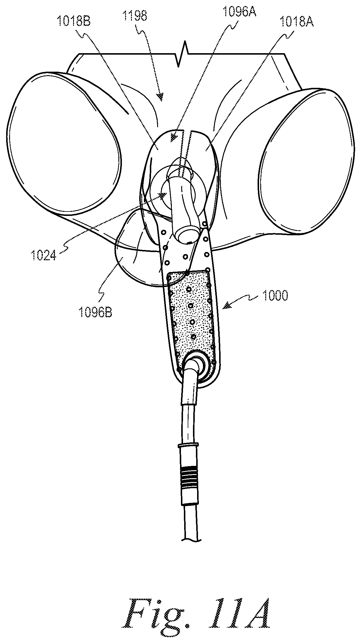 Patent US11779485 Figure 15 – Devices and systems for urine collection