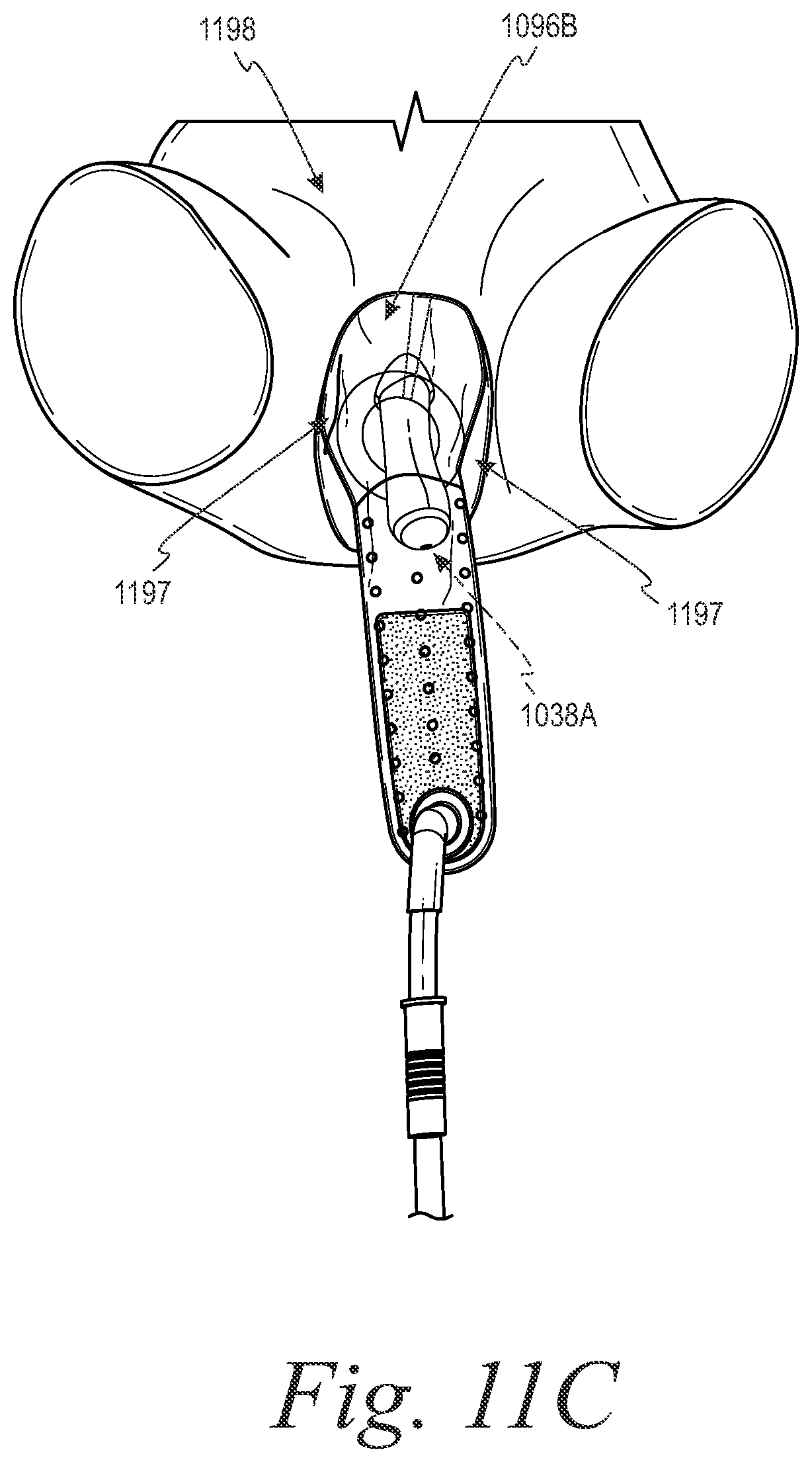 Patent US11779485 Figure 17 – Devices and systems for urine collection