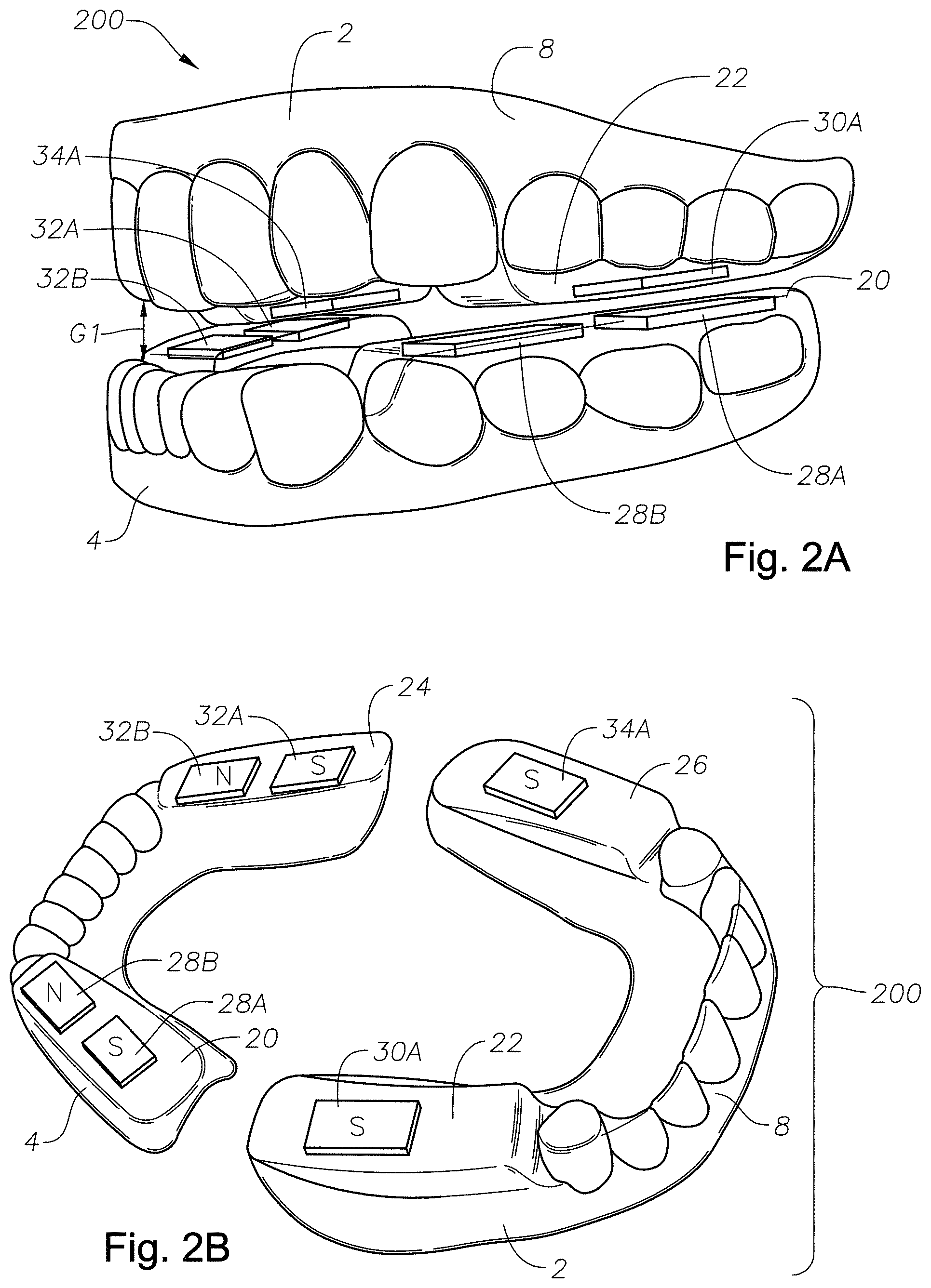 Patent US11779486 Figure 3 – Mouth guards, kits, and methods