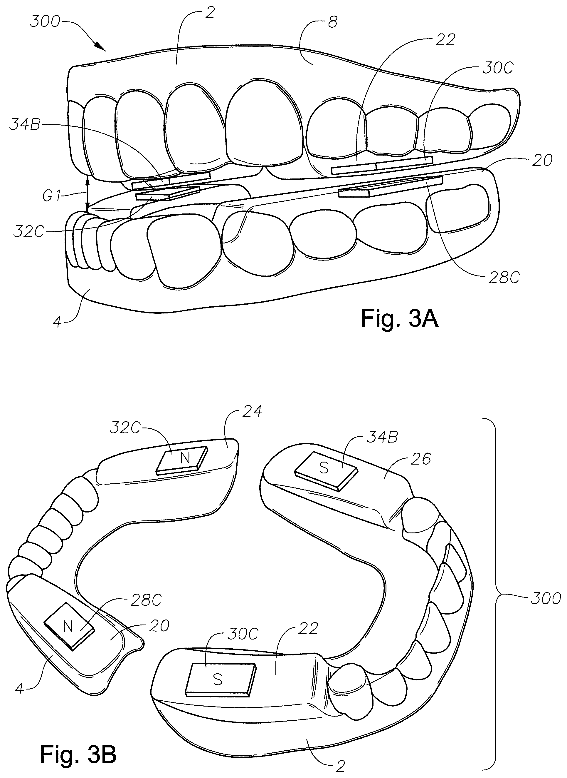Patent US11779486 Figure 4 – Mouth guards, kits, and methods
