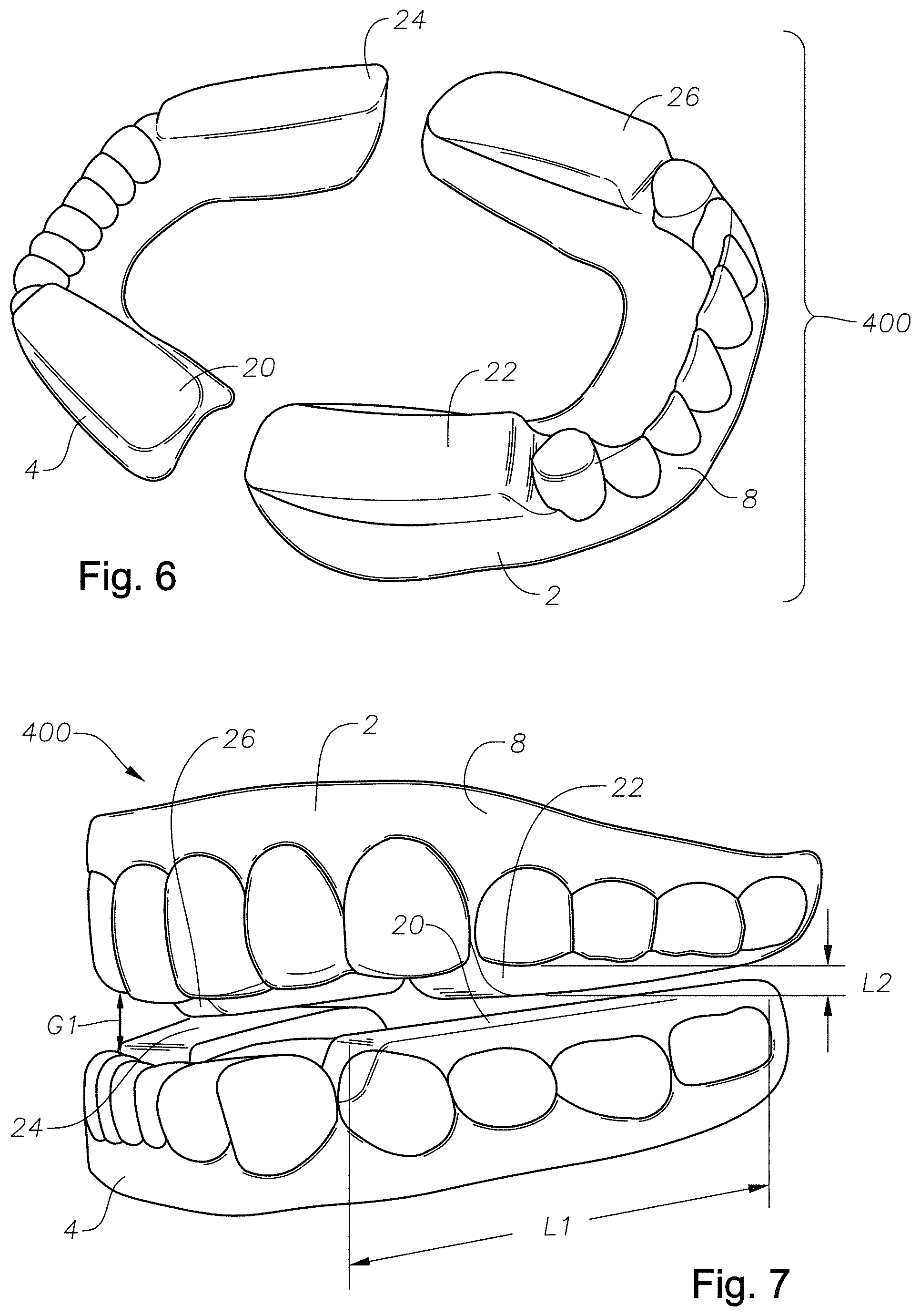 Patent US11779486 Figure 7 – Mouth guards, kits, and methods