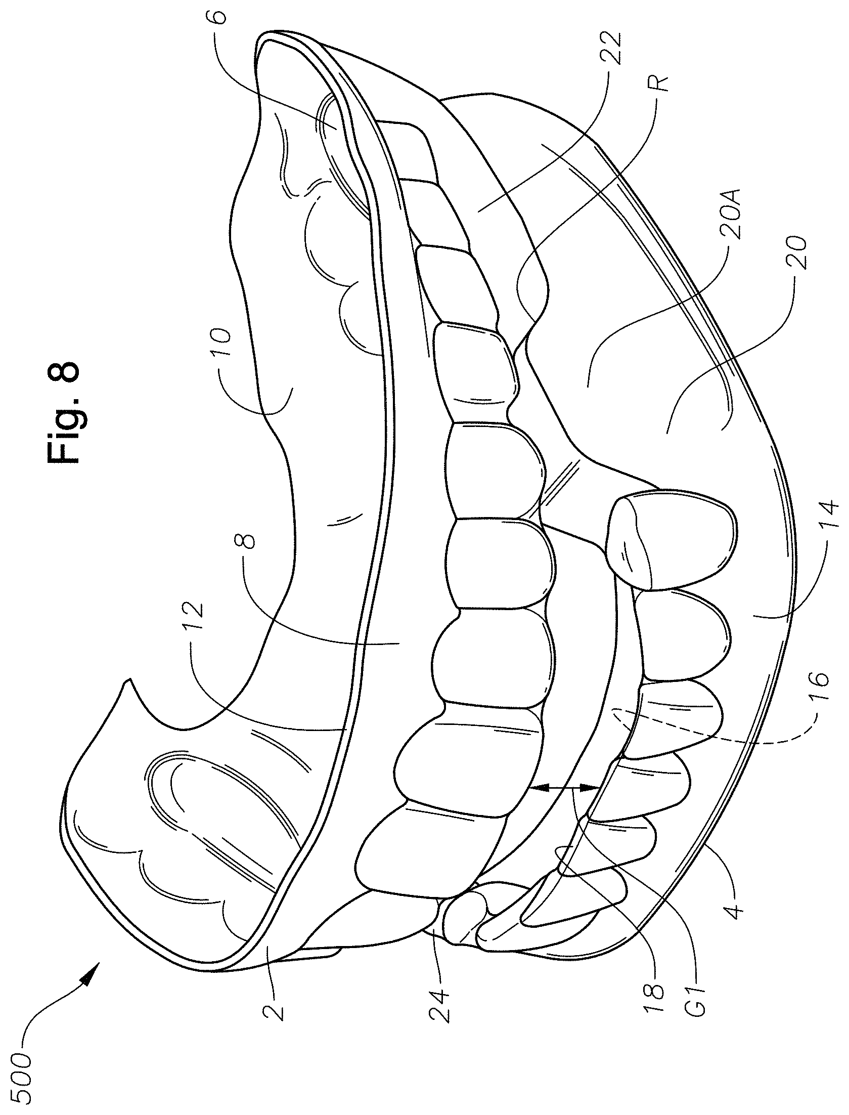 Patent US11779486 Figure 8 – Mouth guards, kits, and methods