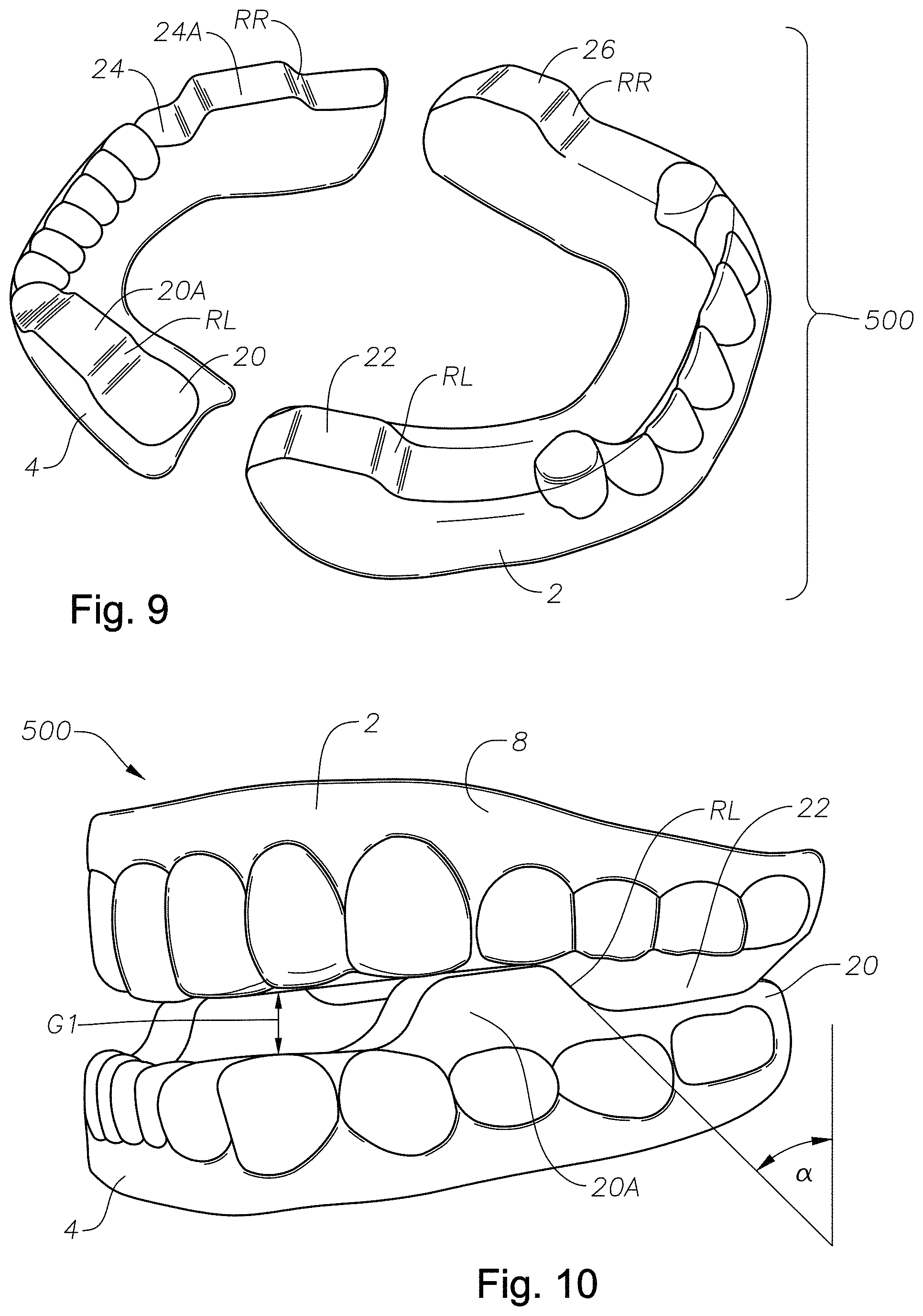 Patent US11779486 Figure 9 – Mouth guards, kits, and methods