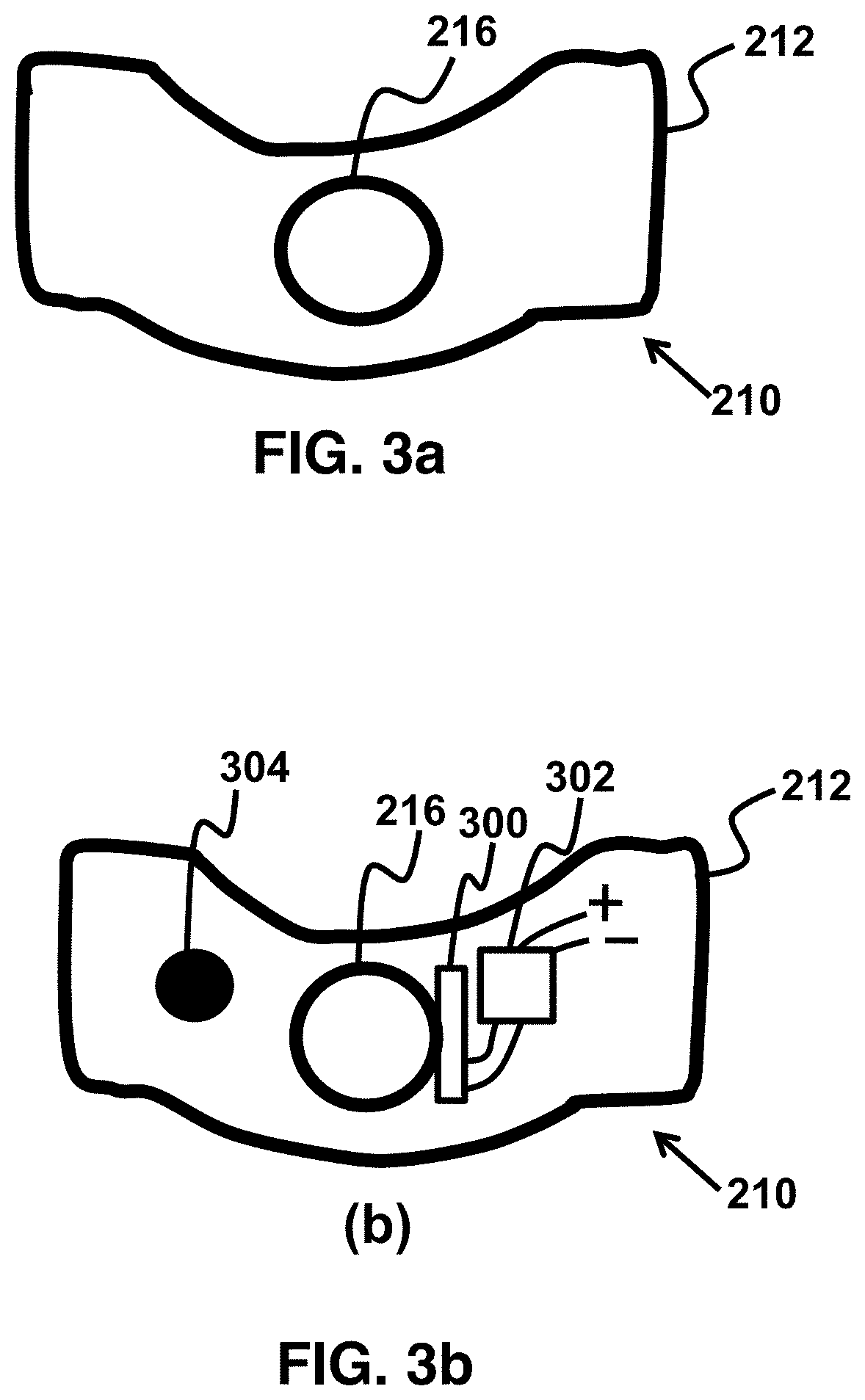 Patent US11779487 Figure 2 – Device and method for correcting obstructive sleep apnea