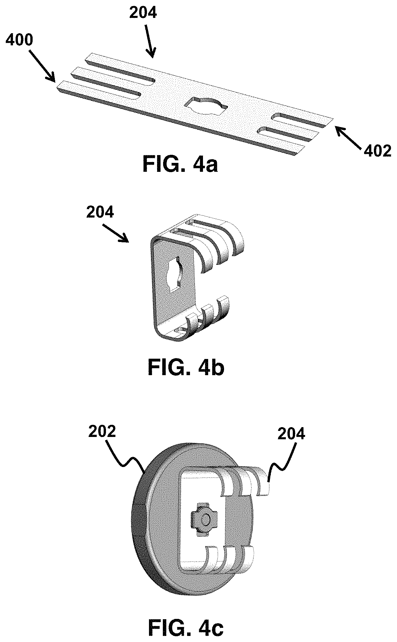 Patent US11779487 Figure 3 – Device and method for correcting obstructive sleep apnea