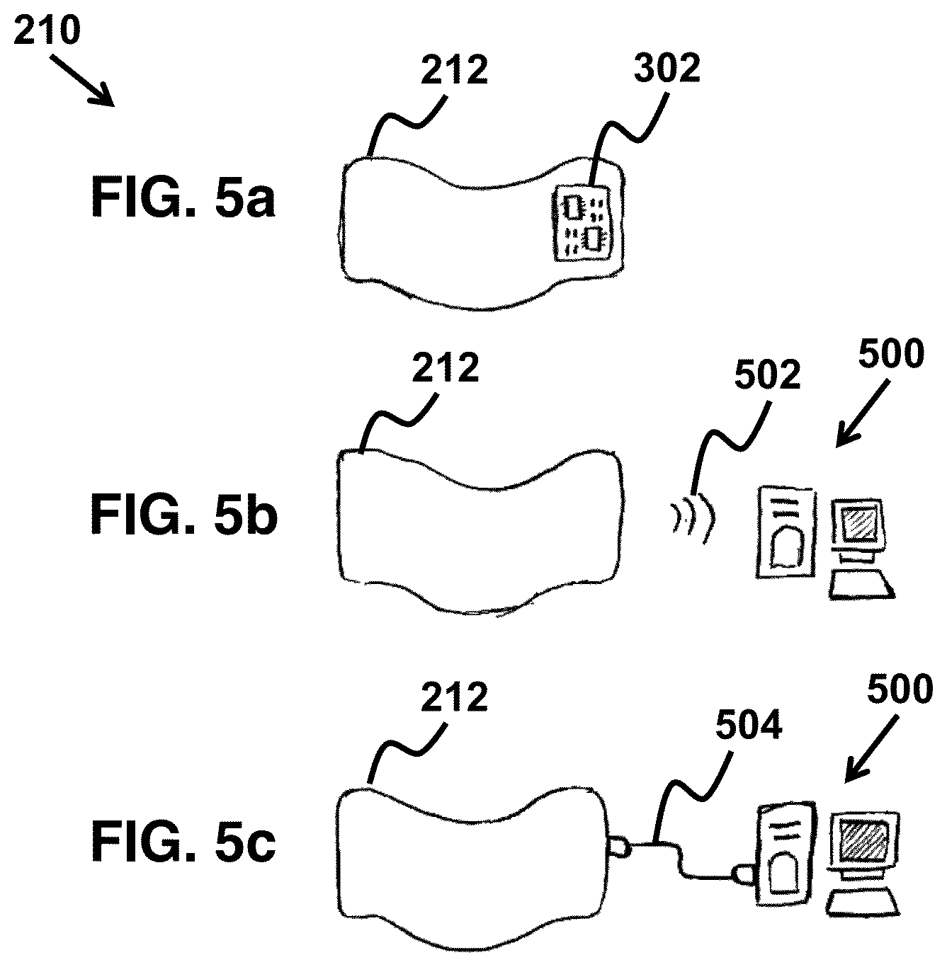 Patent US11779487 Figure 4 – Device and method for correcting obstructive sleep apnea