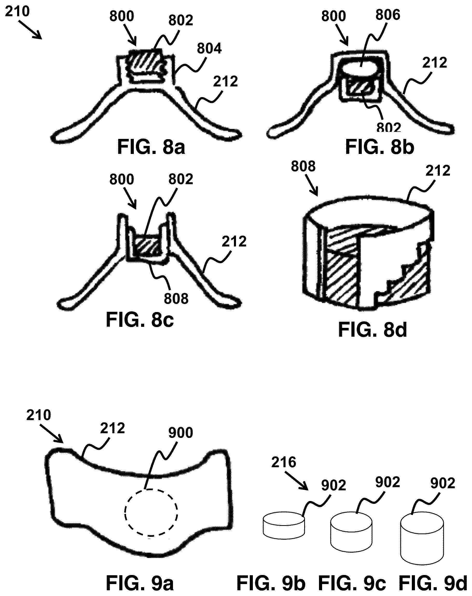 Patent US11779487 Figure 6 – Device and method for correcting obstructive sleep apnea