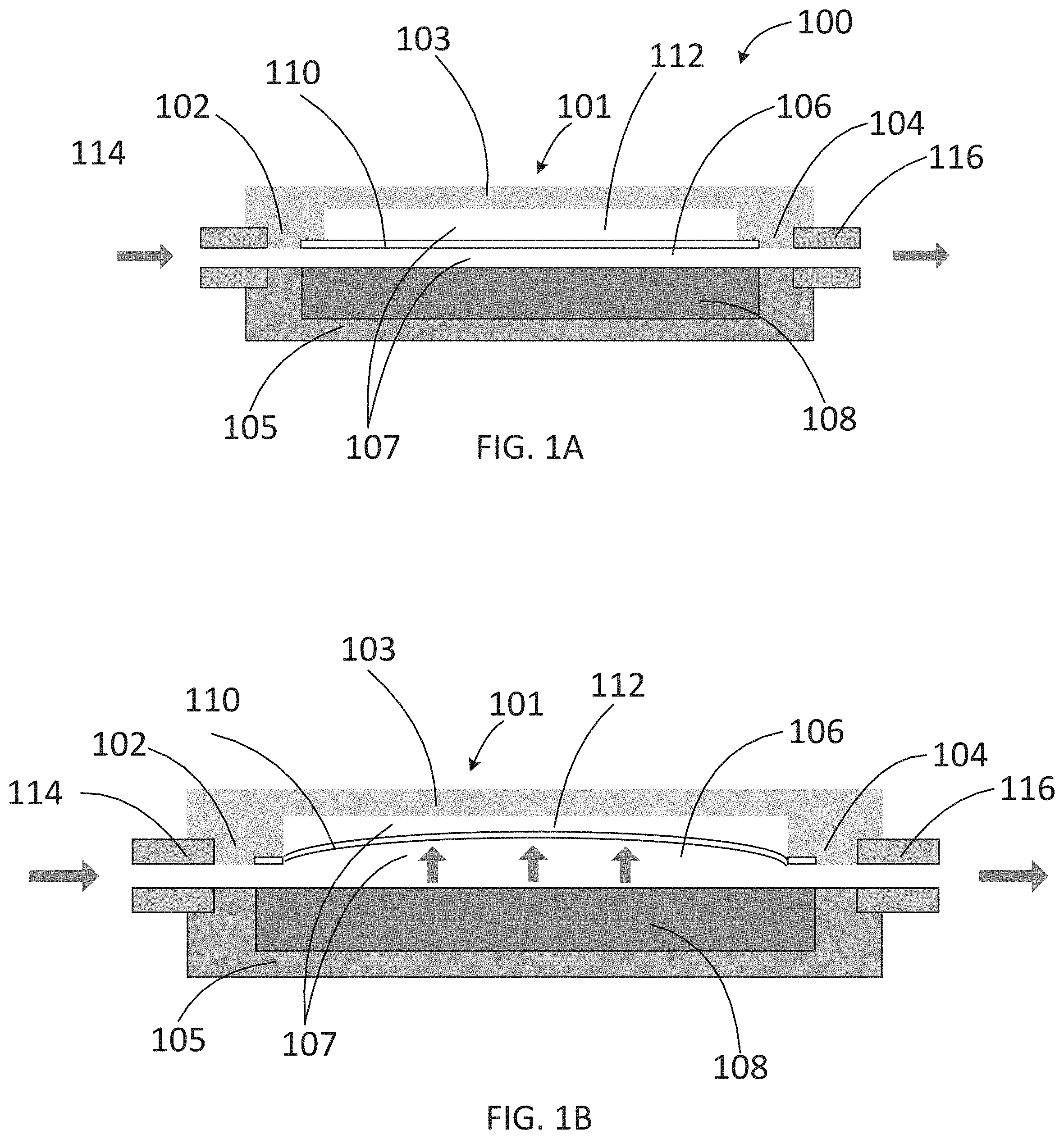 Patent US11779489 Figure 1 – Apparatus for treating excess intraocular fluid having an elastic membrane