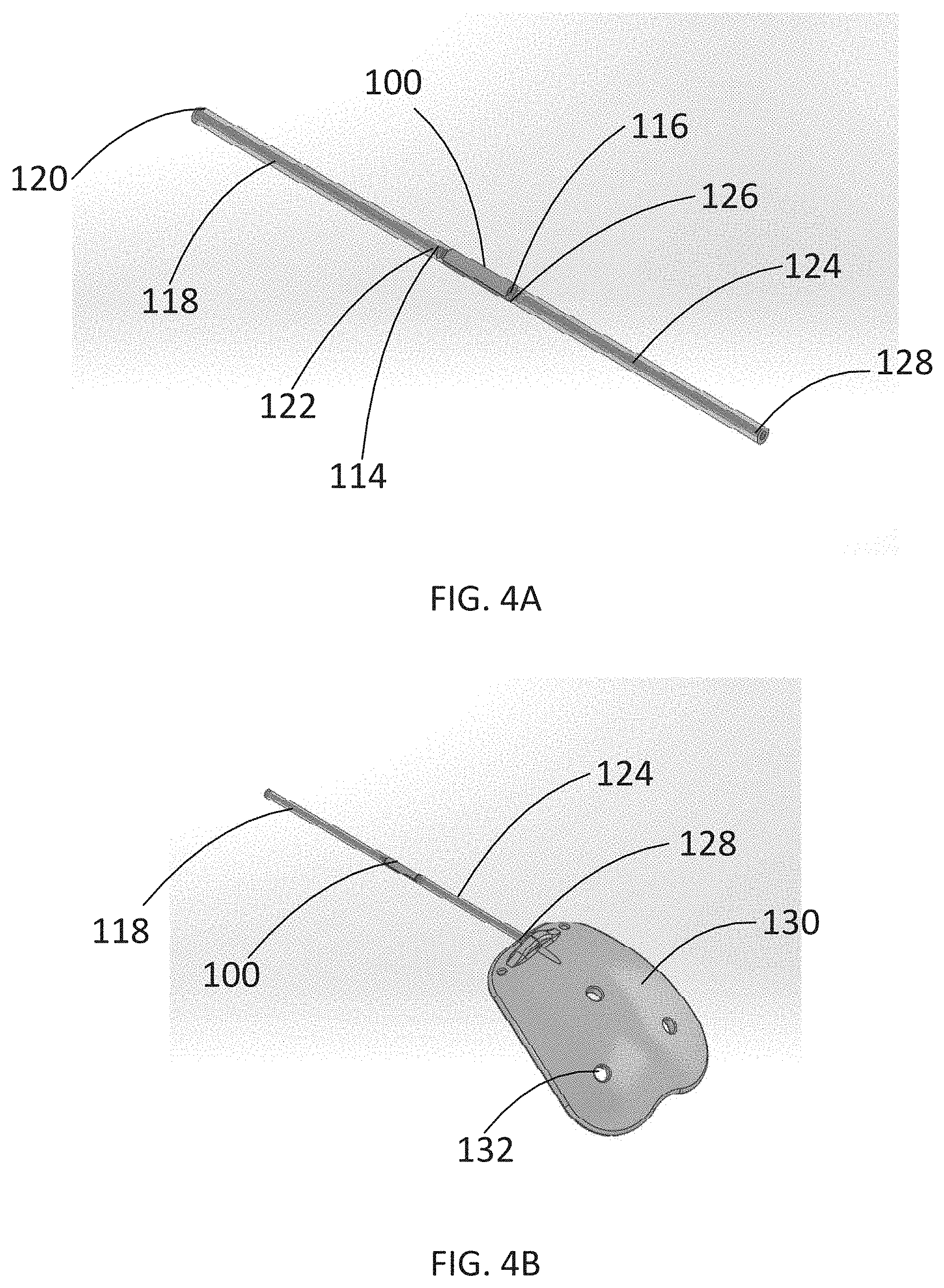 Patent US11779489 Figure 4 – Apparatus for treating excess intraocular fluid having an elastic membrane
