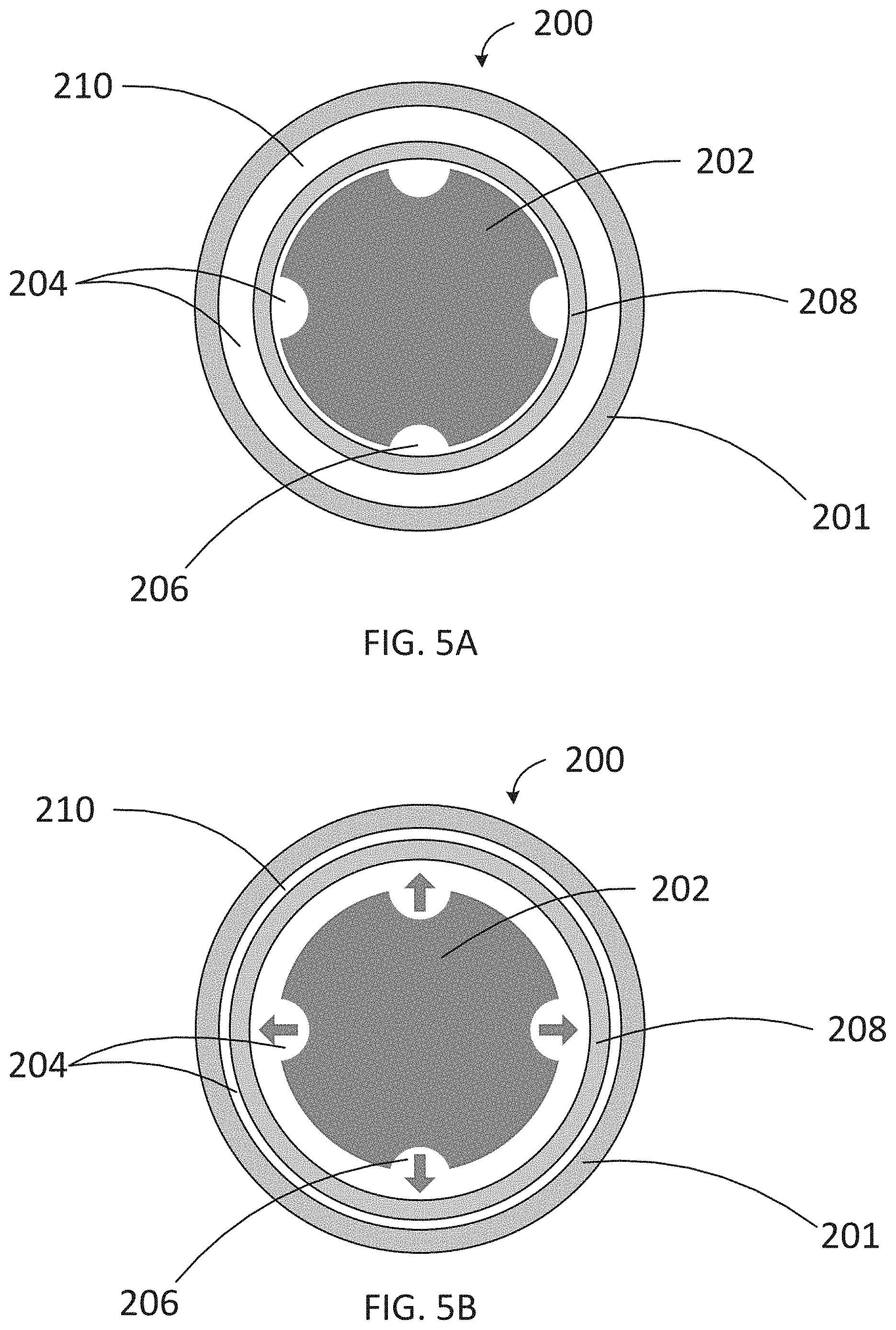 Patent US11779489 Figure 5 – Apparatus for treating excess intraocular fluid having an elastic membrane