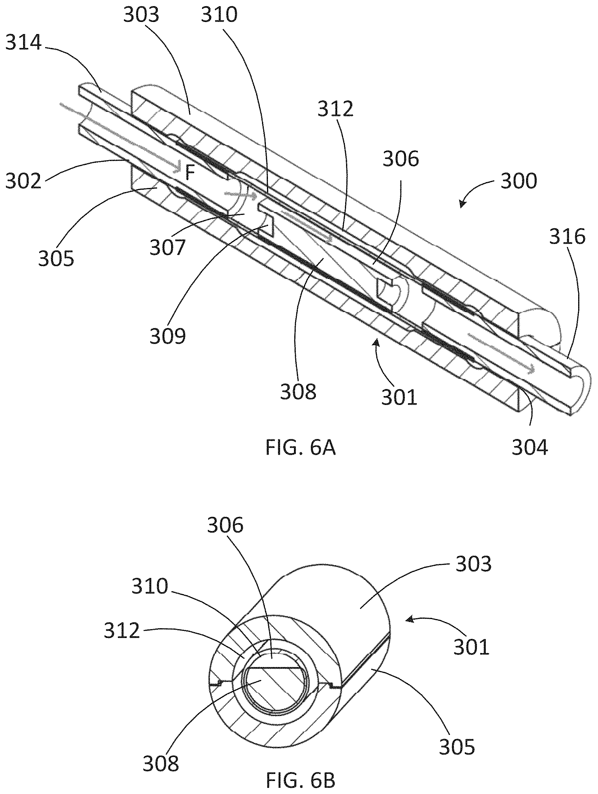 Patent US11779489 Figure 6 – Apparatus for treating excess intraocular fluid having an elastic membrane
