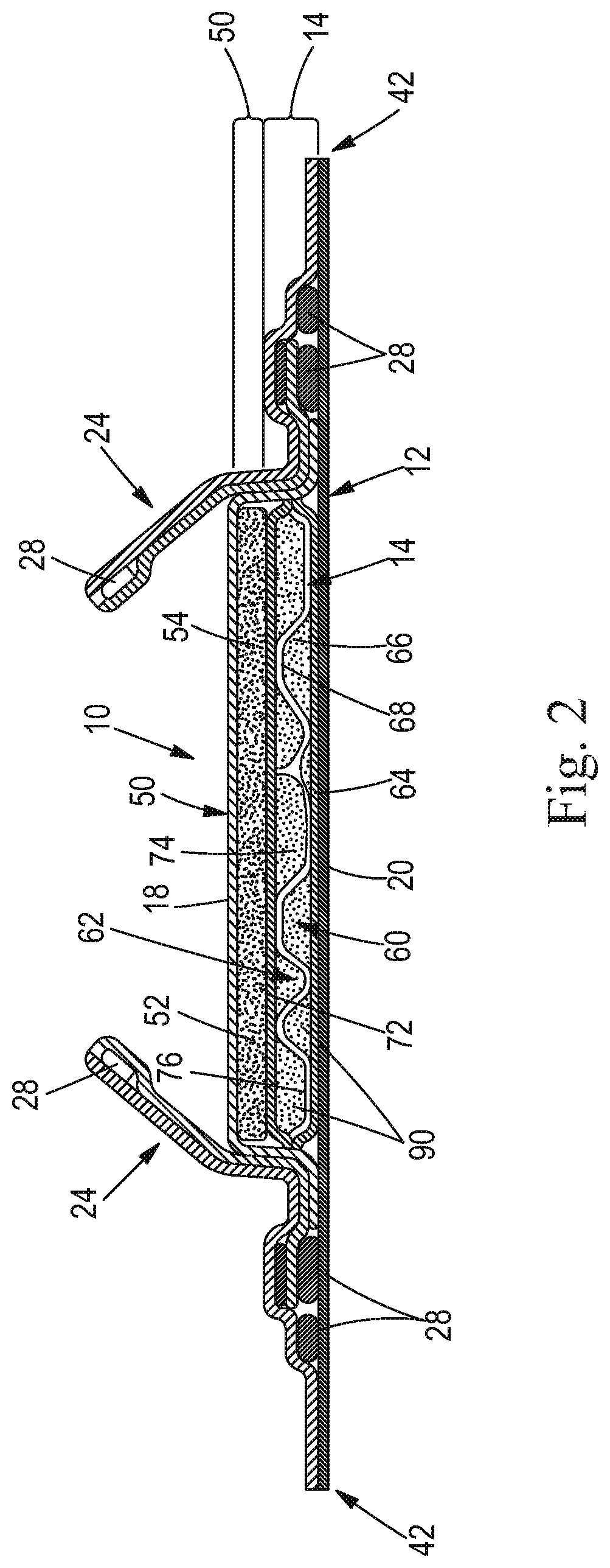 Patent US11779496 Figure 2 – Absorbent cores comprising a superabsorbent polymer immobilizing material