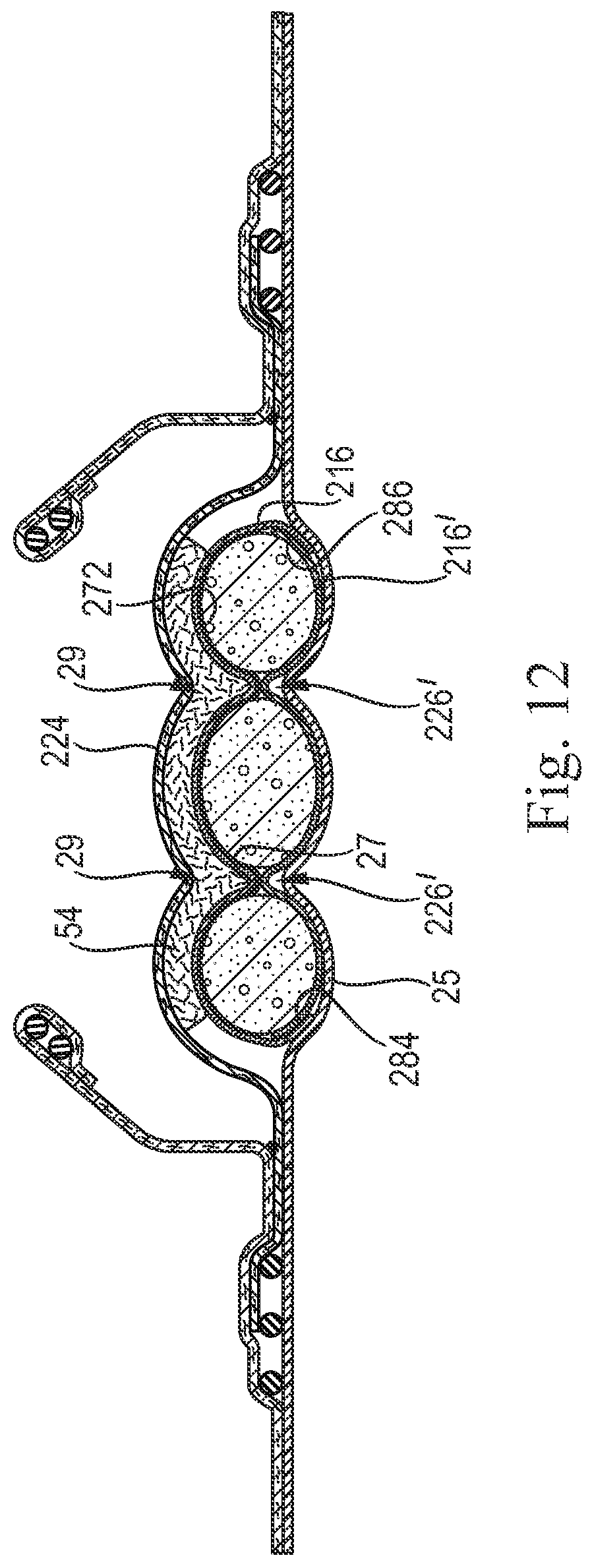 Patent US11779496 Figure 11 – Absorbent cores comprising a superabsorbent polymer immobilizing material