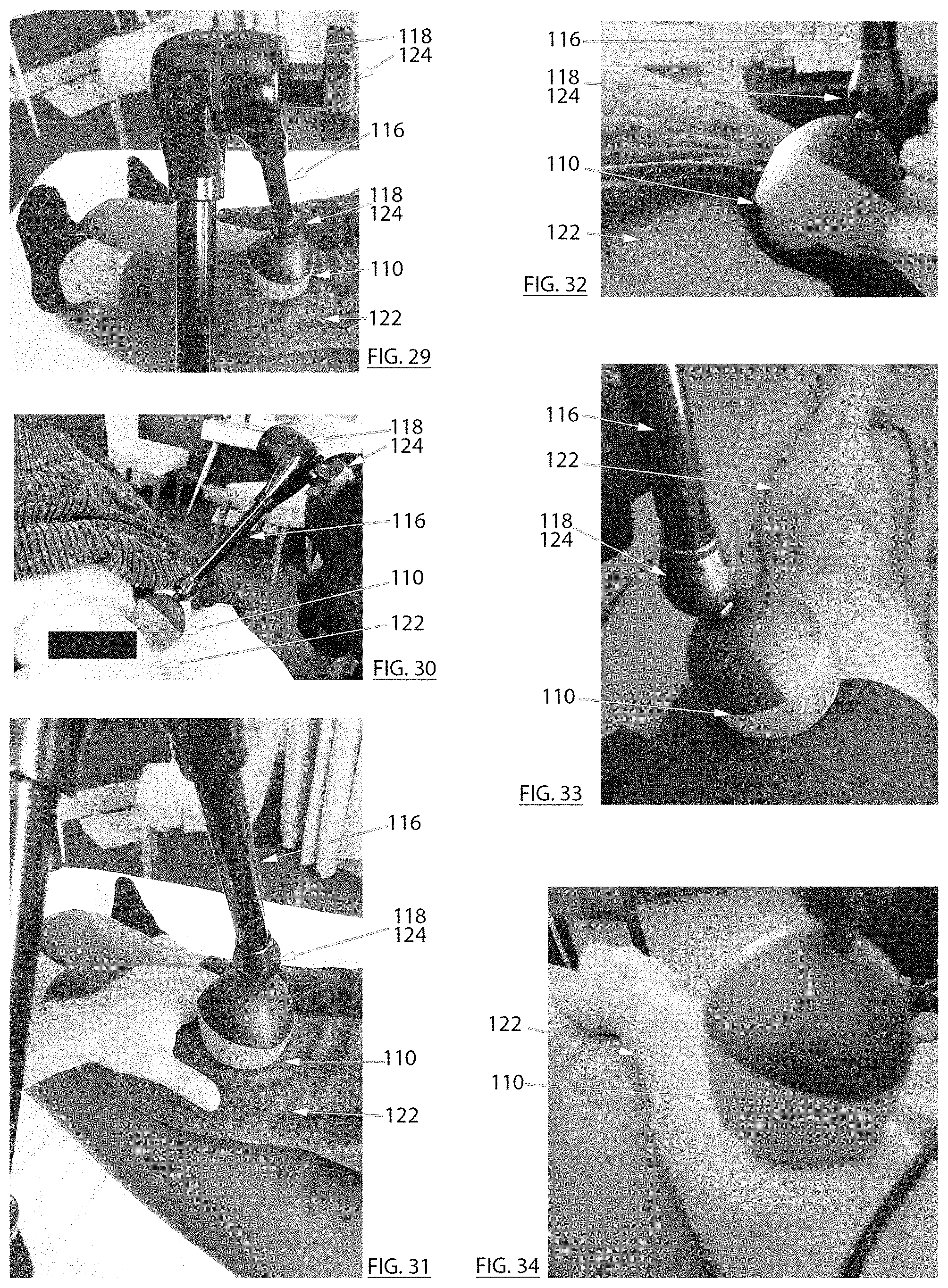Patent US11779503 Figure 9 – Treatment force application device