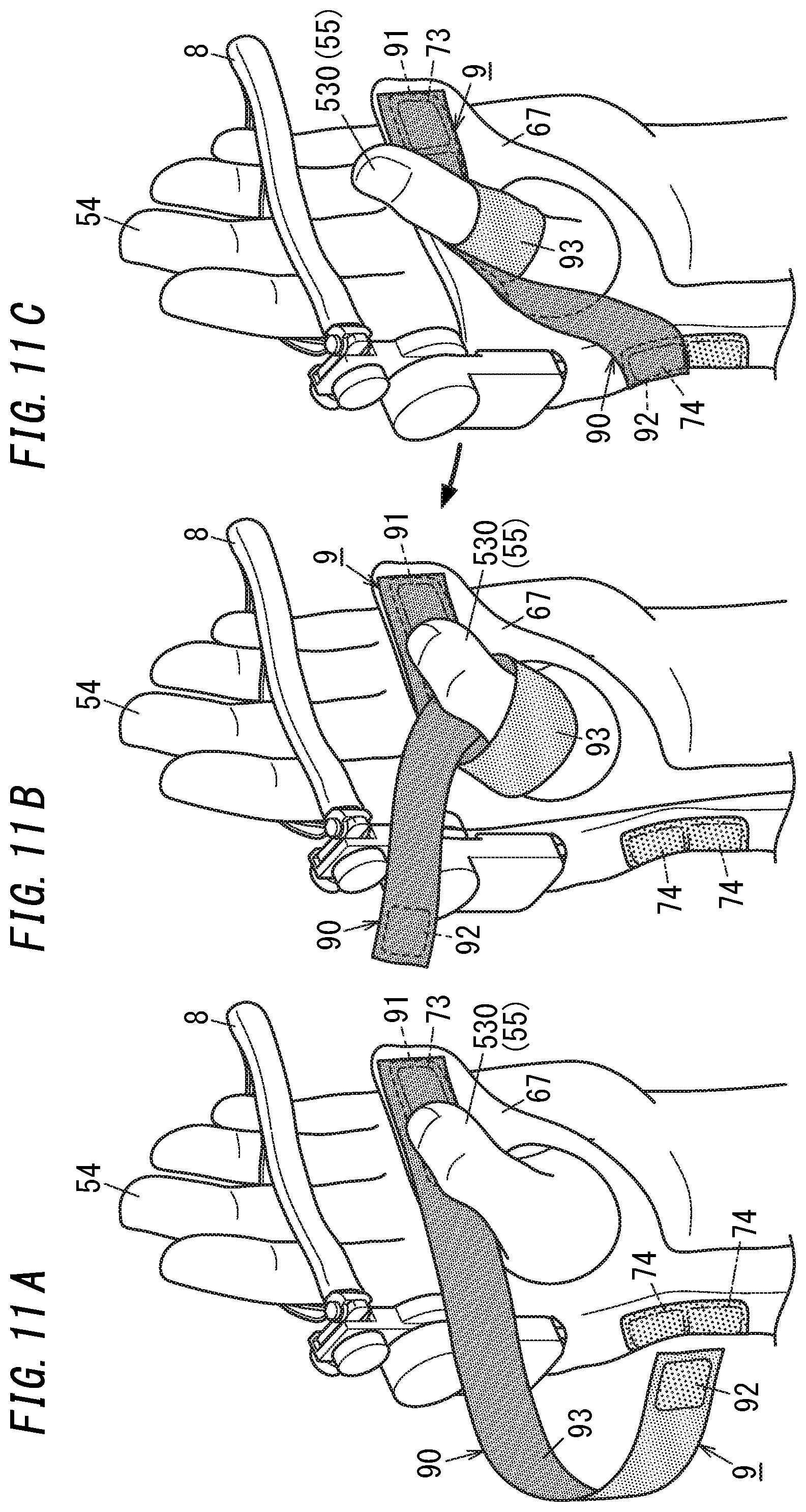 Patent US11779505 Figure 11 – Finger exerciser