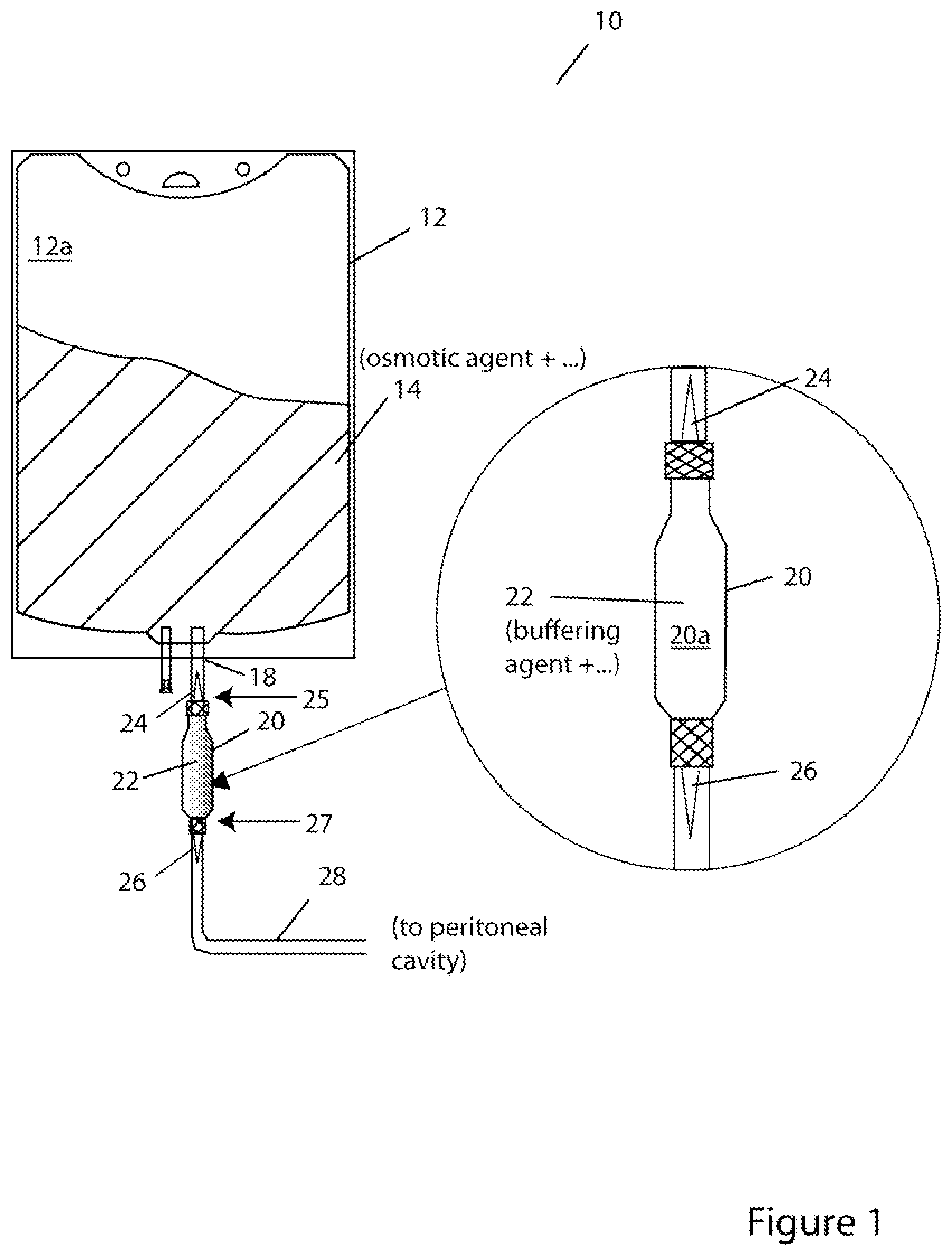 Patent US11779519 Figure 1 – Systems and methods for delivery of peritoneal dialysis (PD) solutions with integrated inter-chamber diffuser