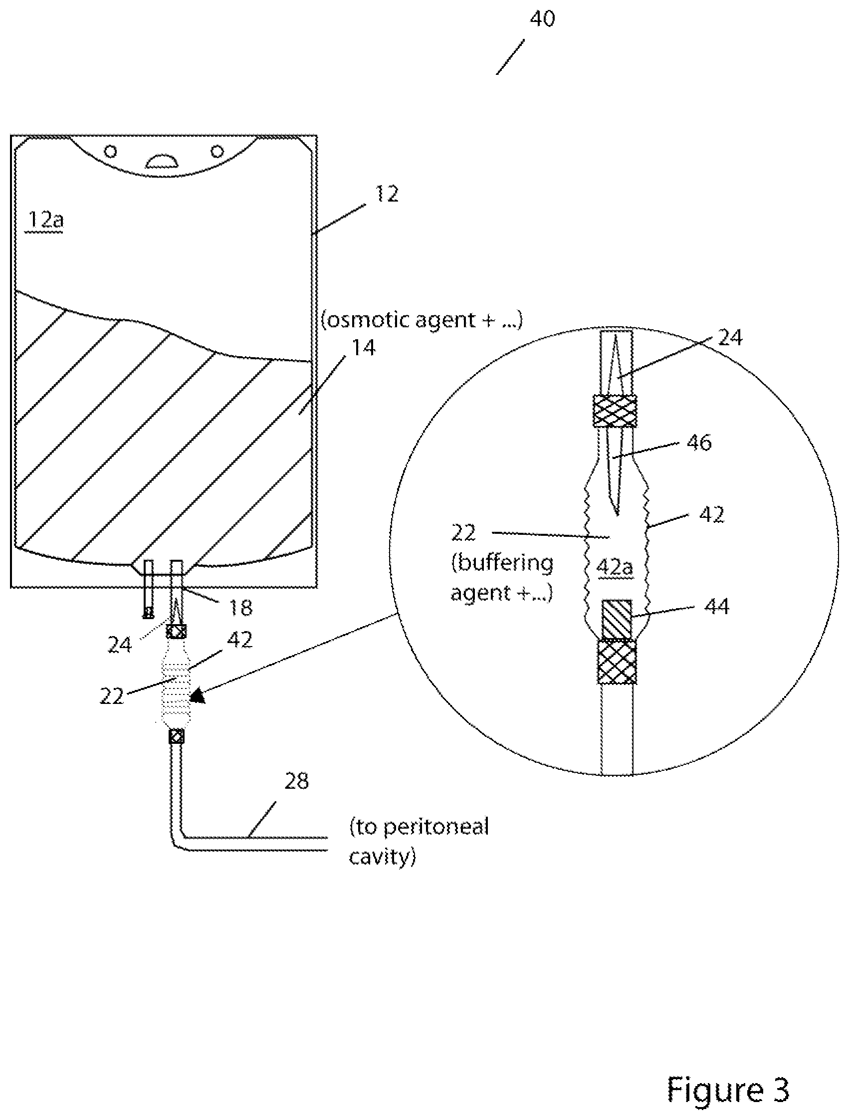 Patent US11779519 Figure 3 – Systems and methods for delivery of peritoneal dialysis (PD) solutions with integrated inter-chamber diffuser
