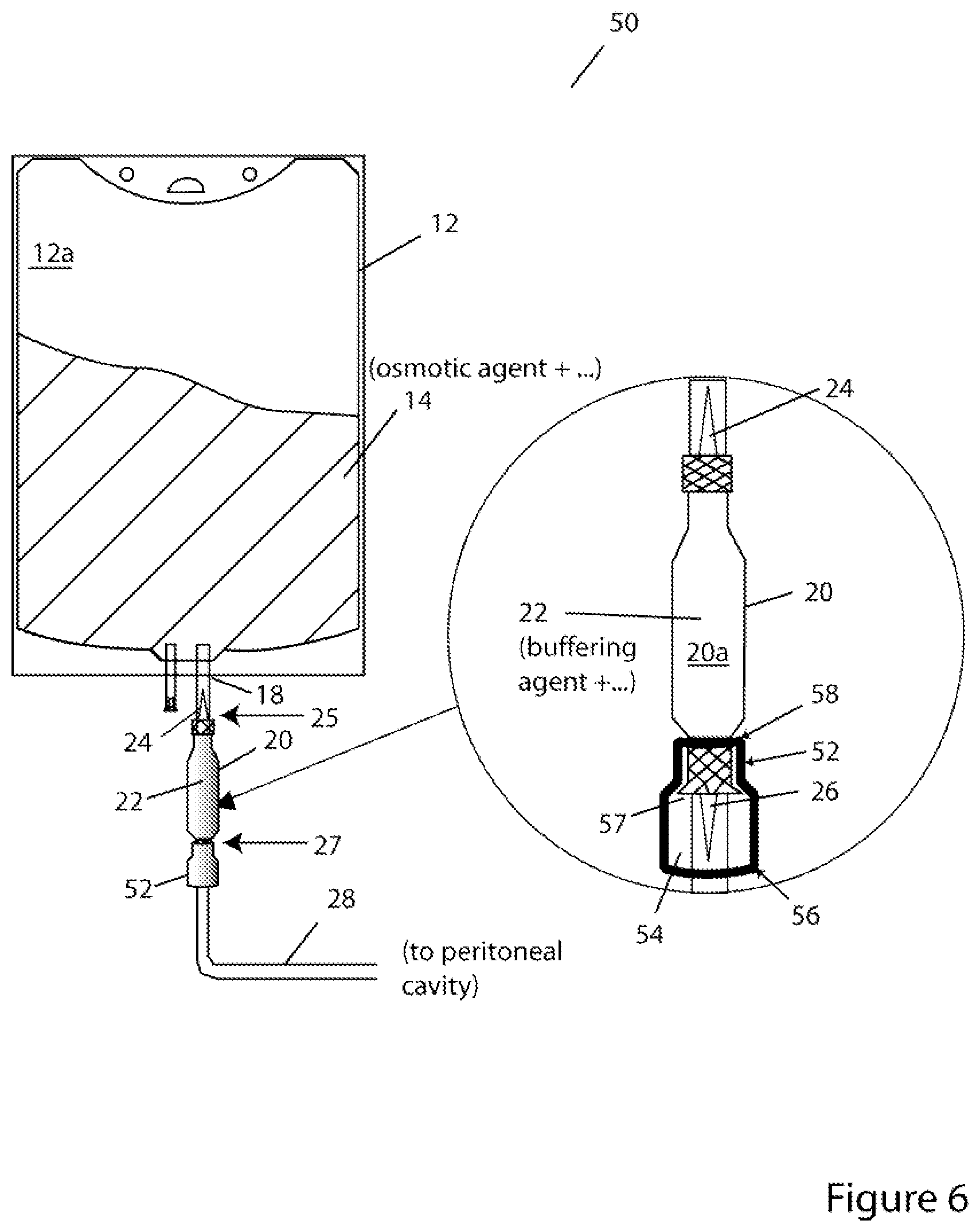 Patent US11779519 Figure 6 – Systems and methods for delivery of peritoneal dialysis (PD) solutions with integrated inter-chamber diffuser