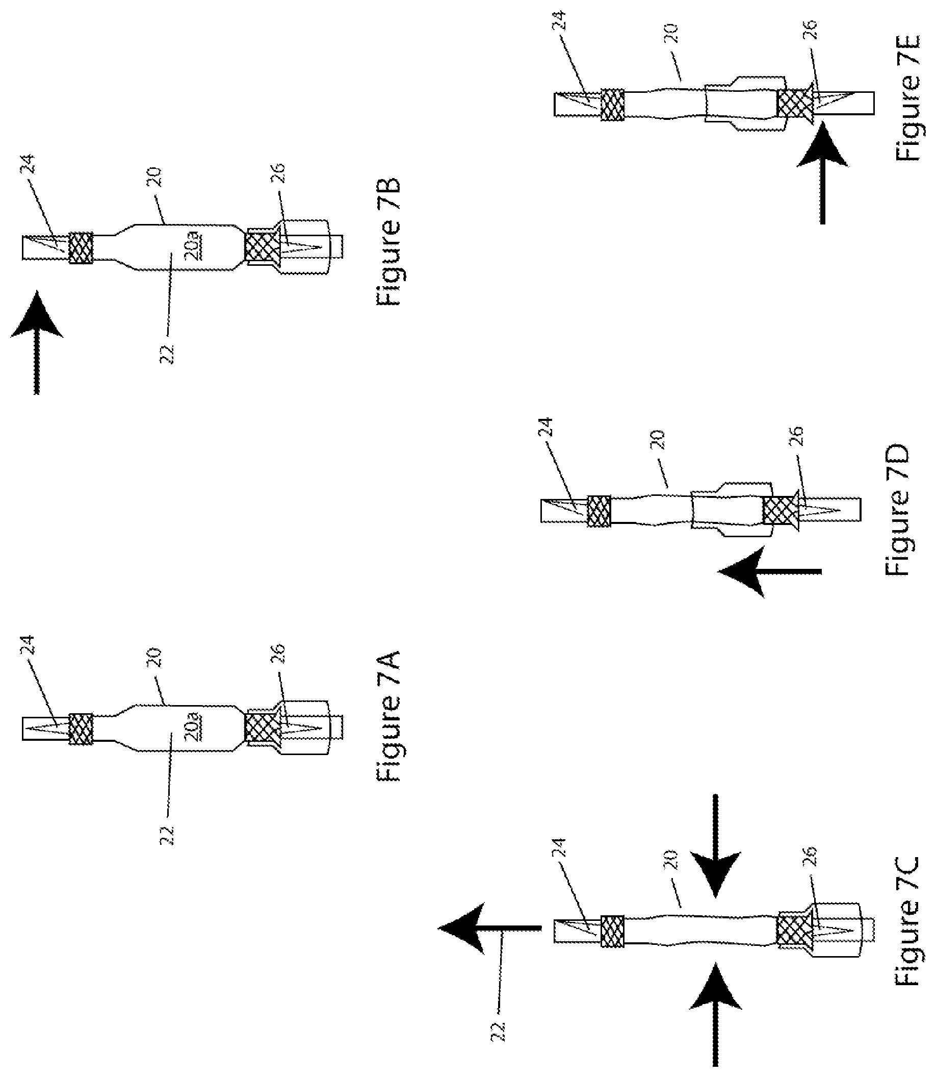 Patent US11779519 Figure 7 – Systems and methods for delivery of peritoneal dialysis (PD) solutions with integrated inter-chamber diffuser