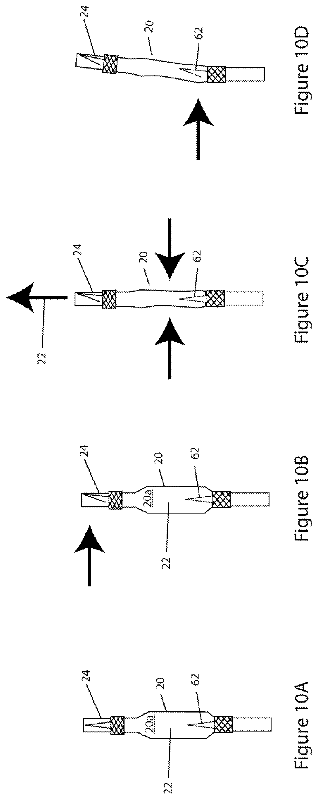 Patent US11779519 Figure 9 – Systems and methods for delivery of peritoneal dialysis (PD) solutions with integrated inter-chamber diffuser