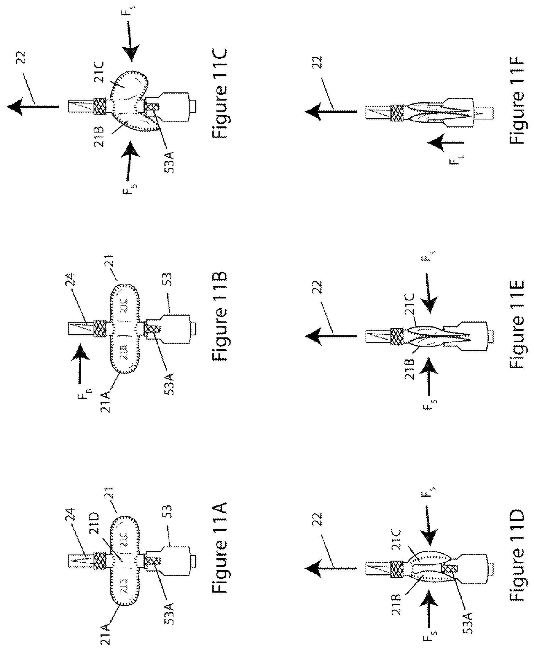 Patent US11779519 Figure 10 – Systems and methods for delivery of peritoneal dialysis (PD) solutions with integrated inter-chamber diffuser