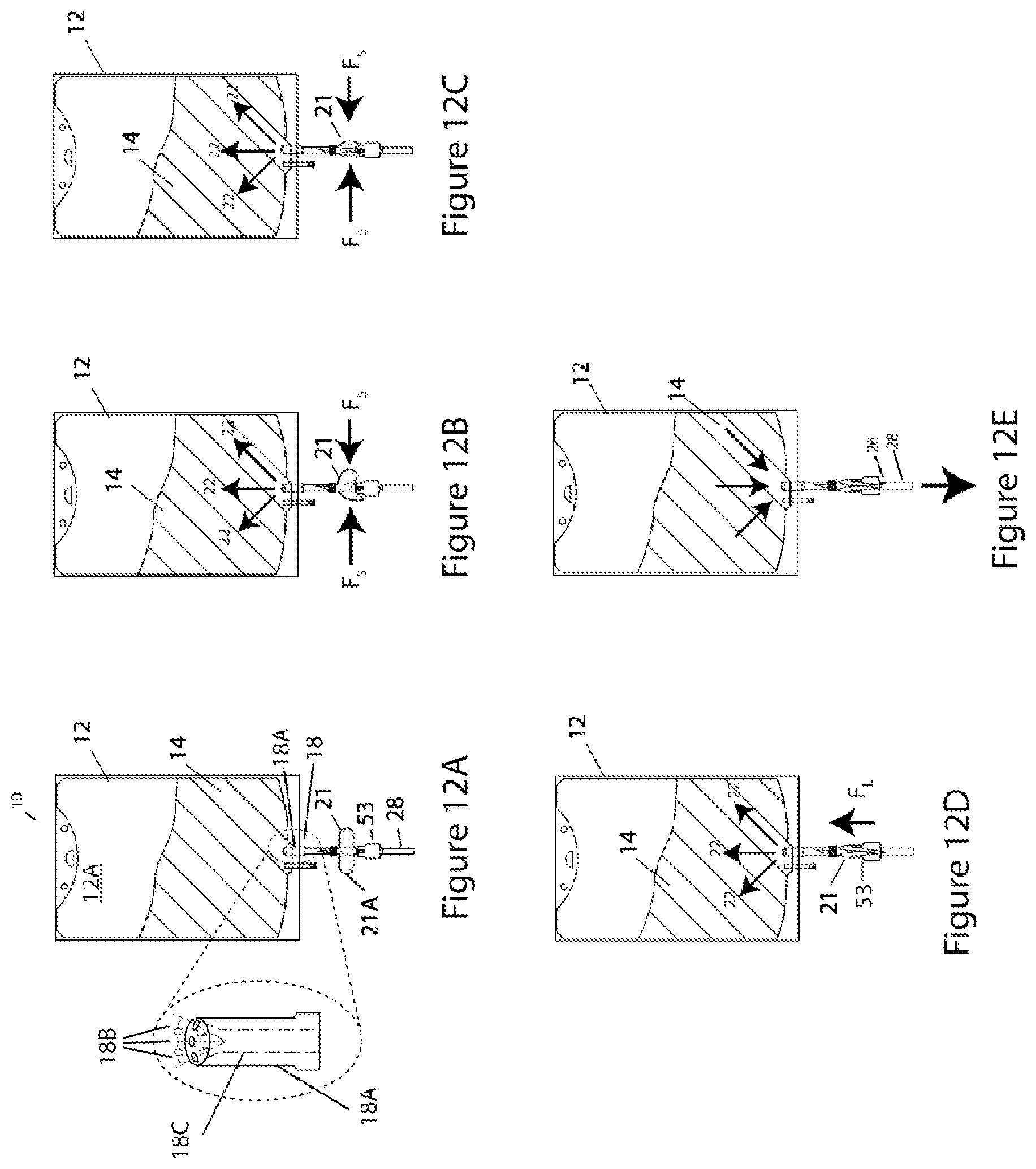 Patent US11779519 Figure 11 – Systems and methods for delivery of peritoneal dialysis (PD) solutions with integrated inter-chamber diffuser