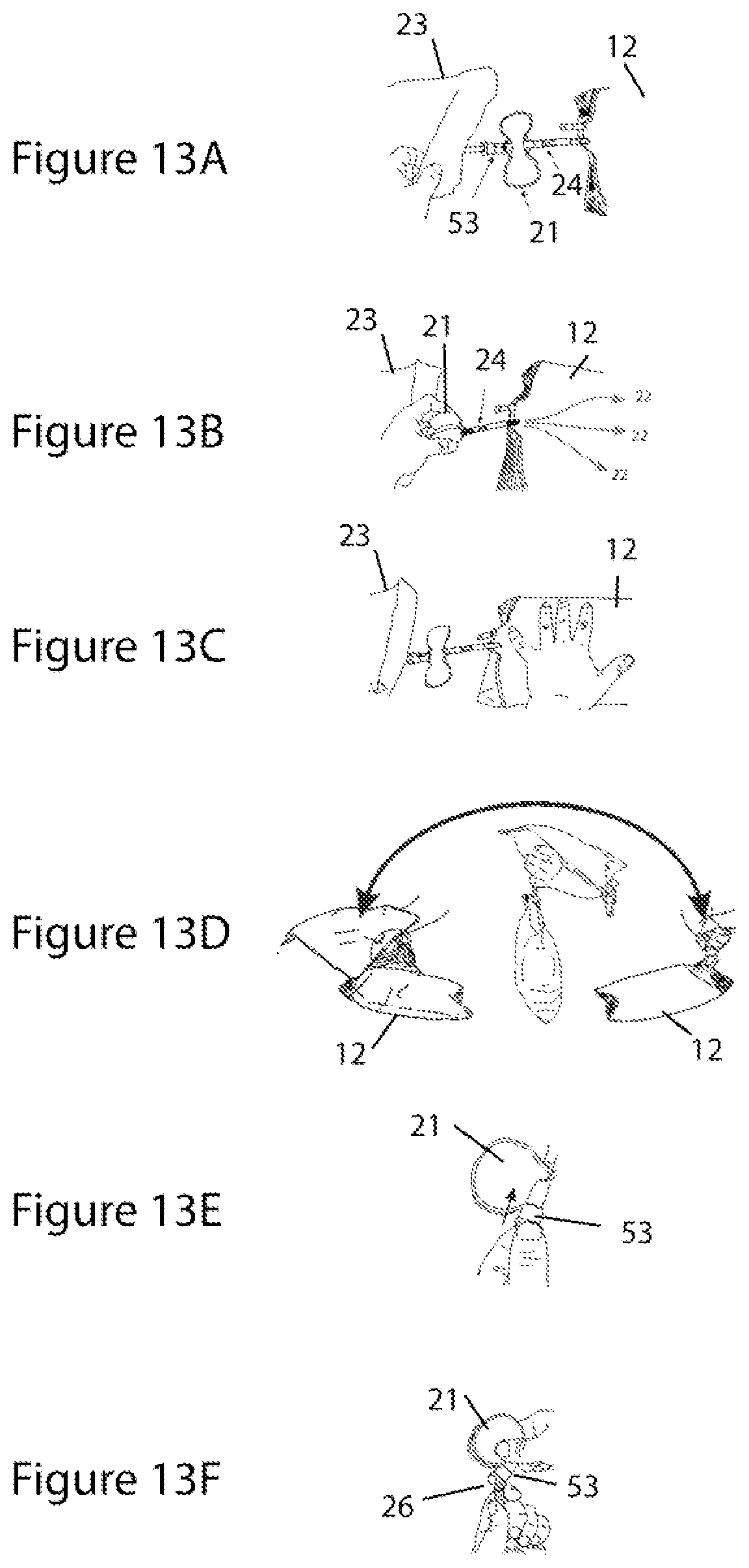 Patent US11779519 Figure 12 – Systems and methods for delivery of peritoneal dialysis (PD) solutions with integrated inter-chamber diffuser