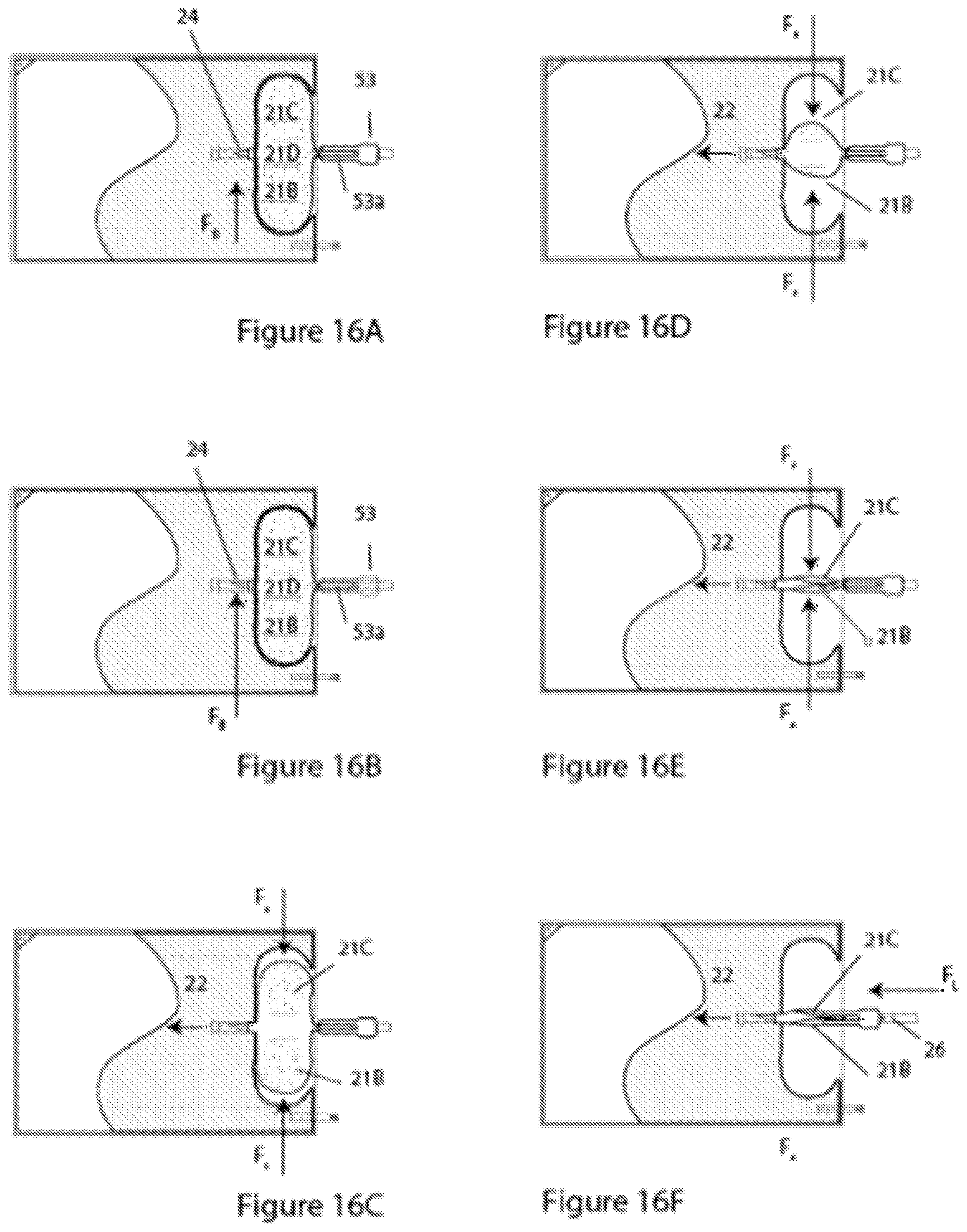 Patent US11779519 Figure 19 – Systems and methods for delivery of peritoneal dialysis (PD) solutions with integrated inter-chamber diffuser