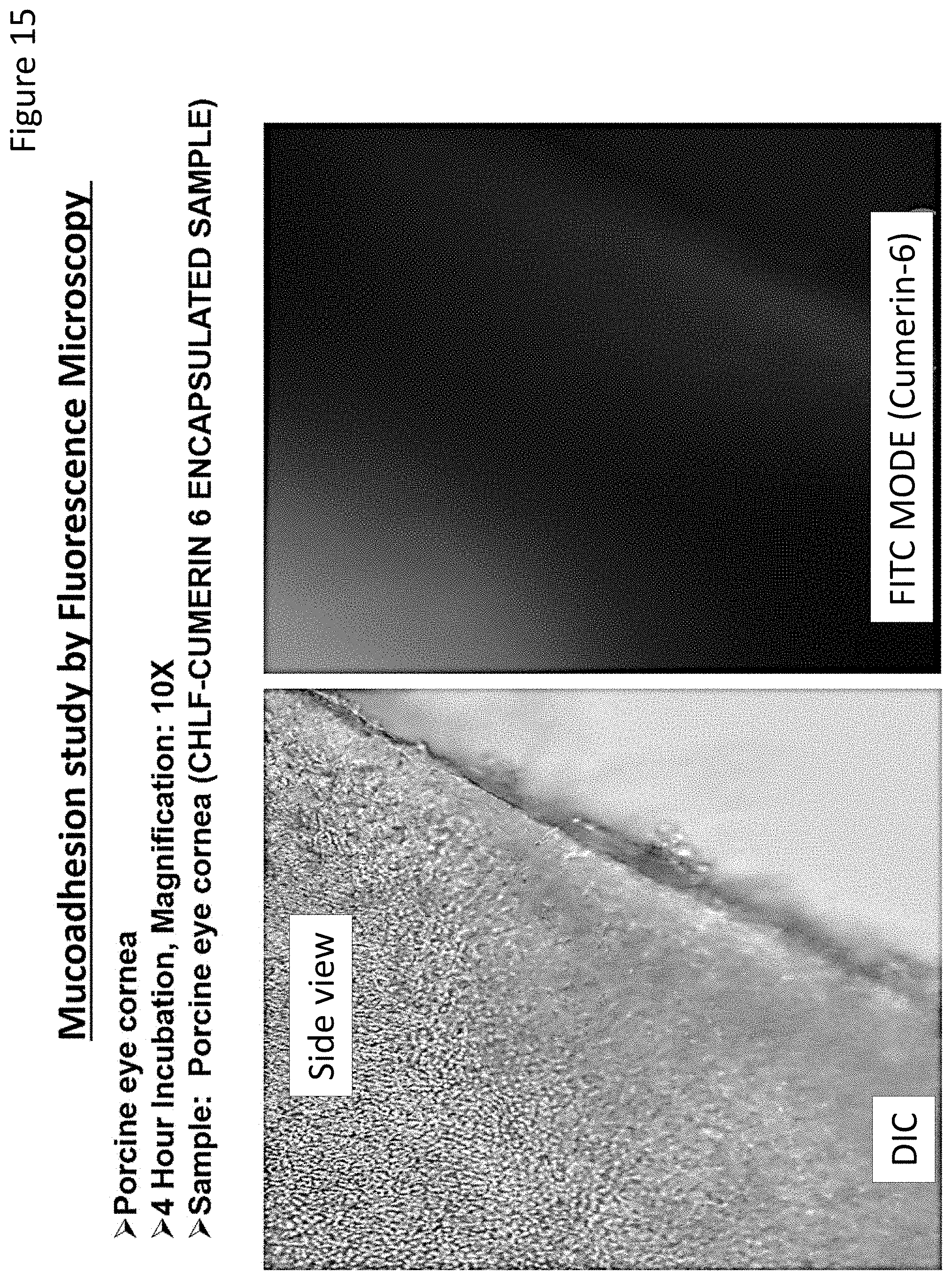 Patent US11779543 Figure 14 – Ocular drug delivery