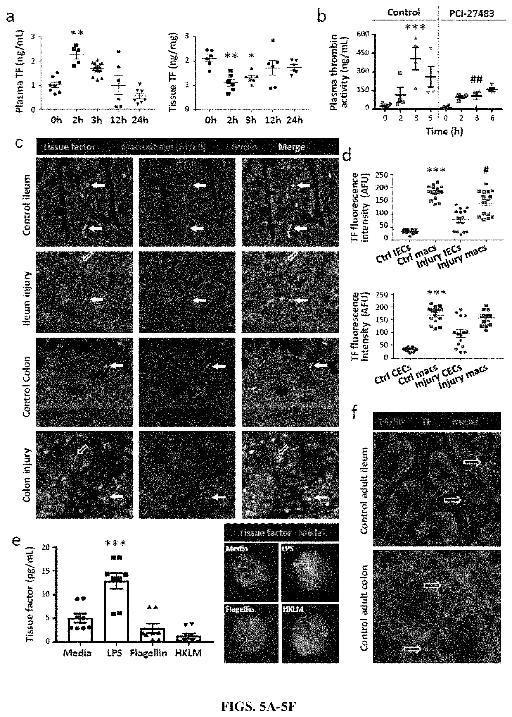 Patent US11779544 Figure 5 – Antithrombotic nanoparticles and methods for treating necrotizing enterocolitis