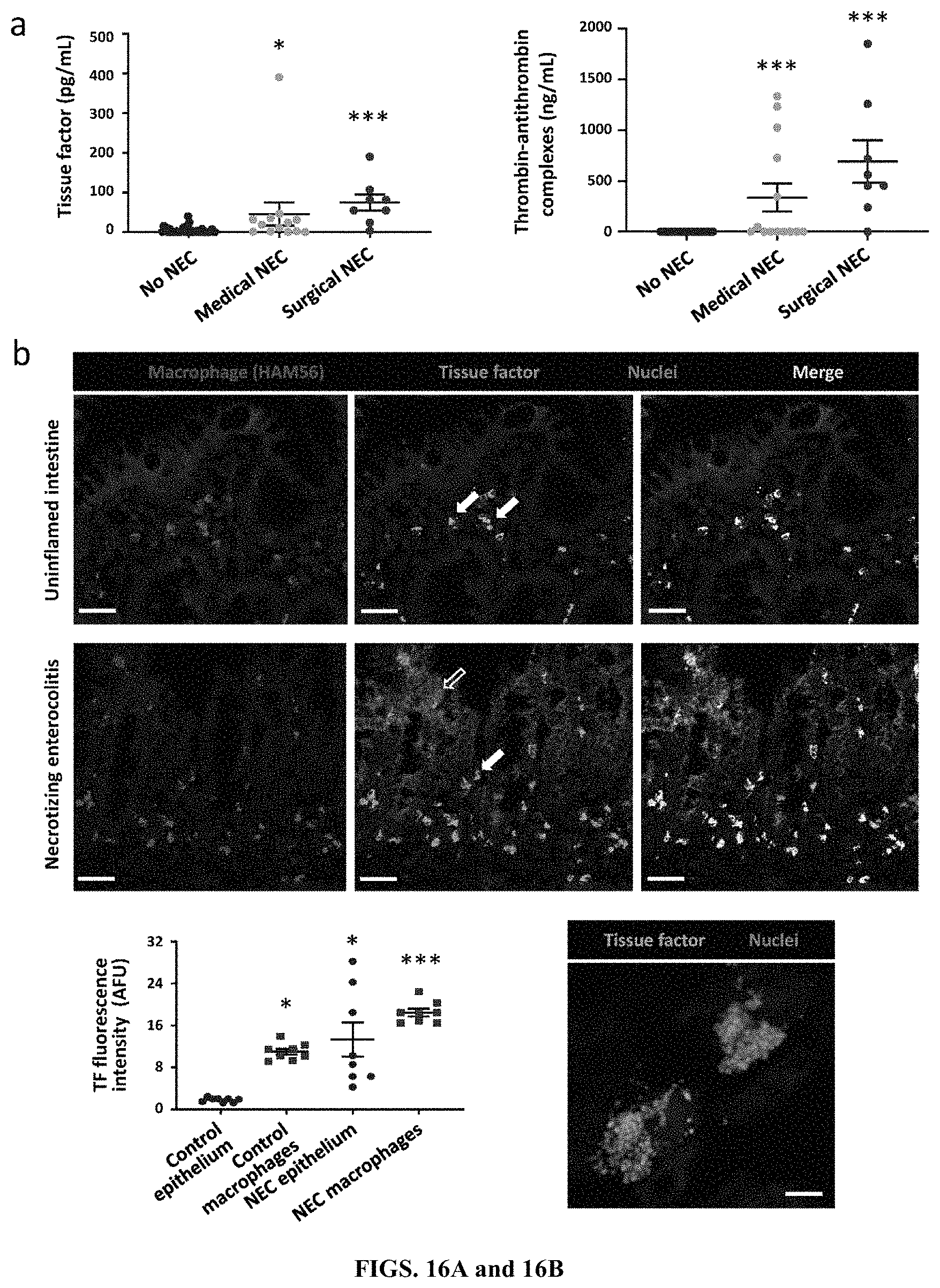 Patent US11779544 Figure 13 – Antithrombotic nanoparticles and methods for treating necrotizing enterocolitis