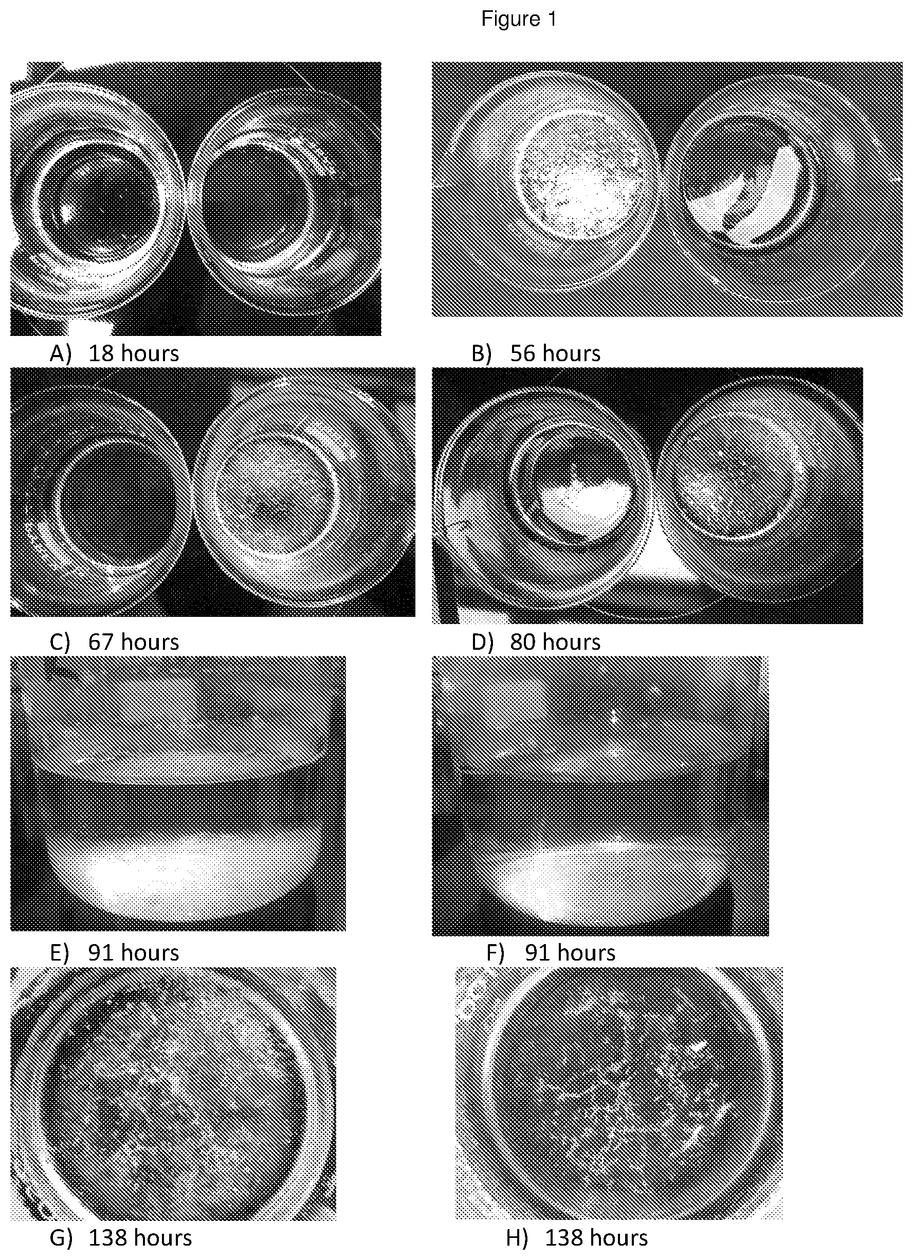 Patent US11779546 Figure 1 – Disassembly of cholesterol crystals