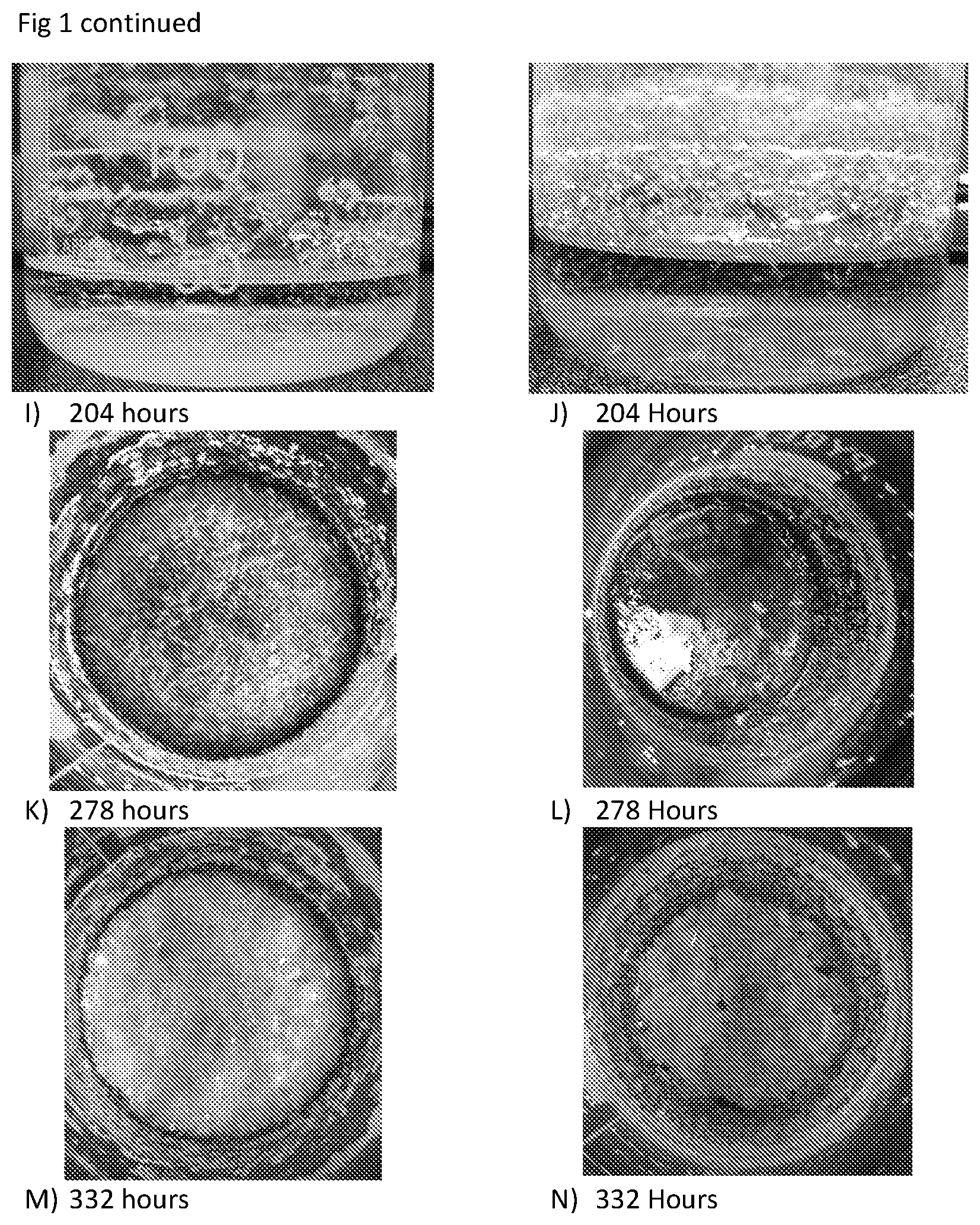 Patent US11779546 Figure 2 – Disassembly of cholesterol crystals