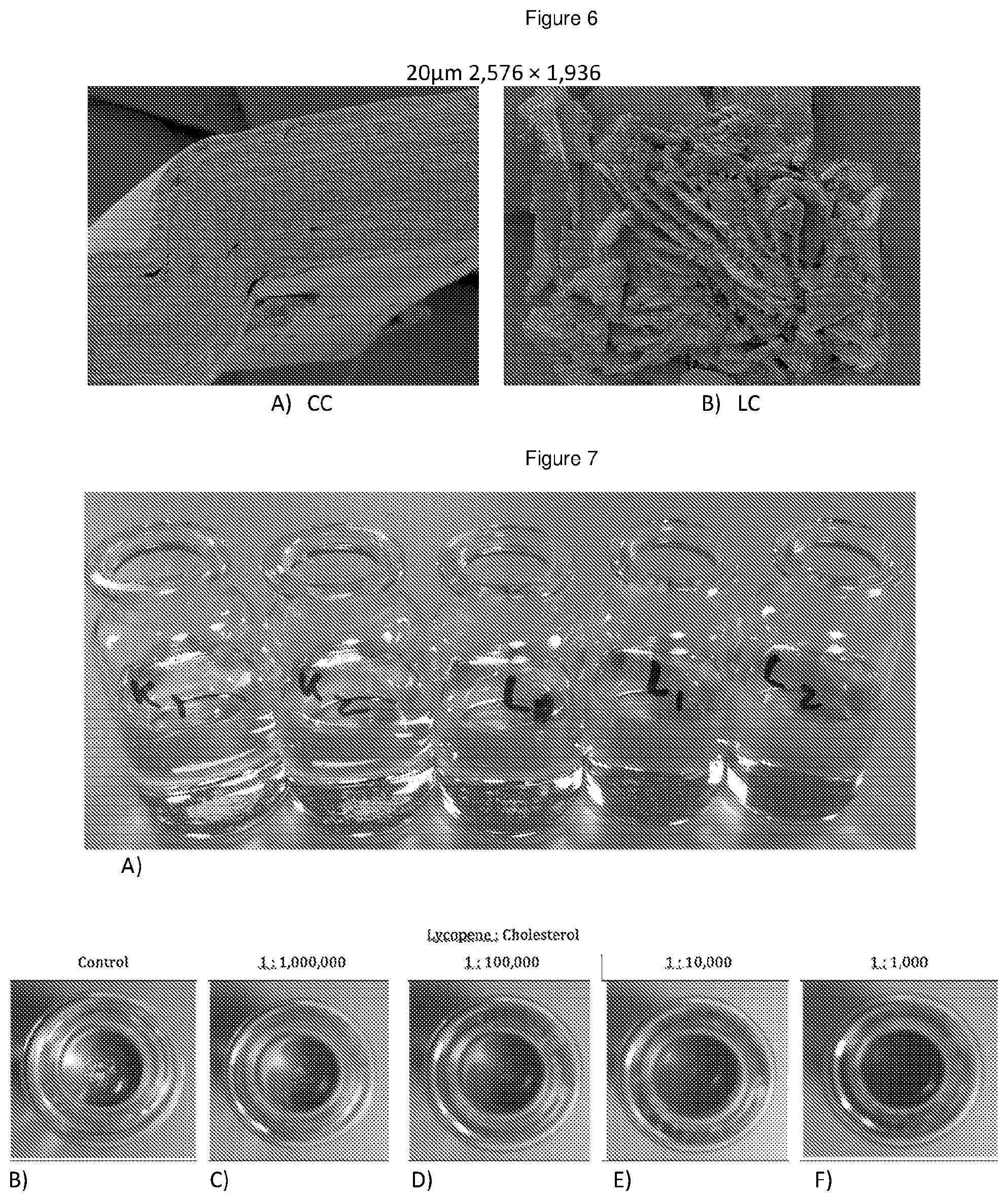 Patent US11779546 Figure 6 – Disassembly of cholesterol crystals