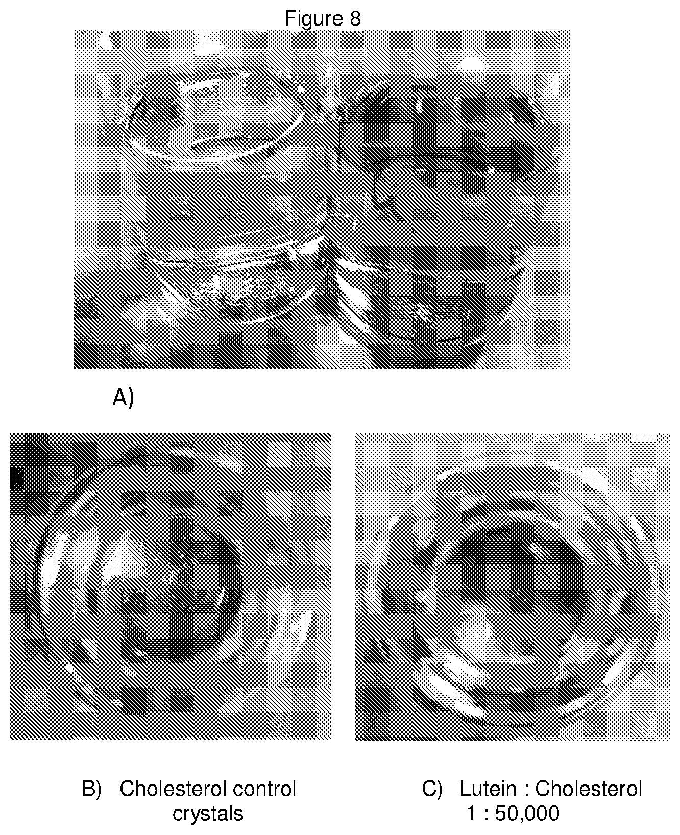 Patent US11779546 Figure 7 – Disassembly of cholesterol crystals