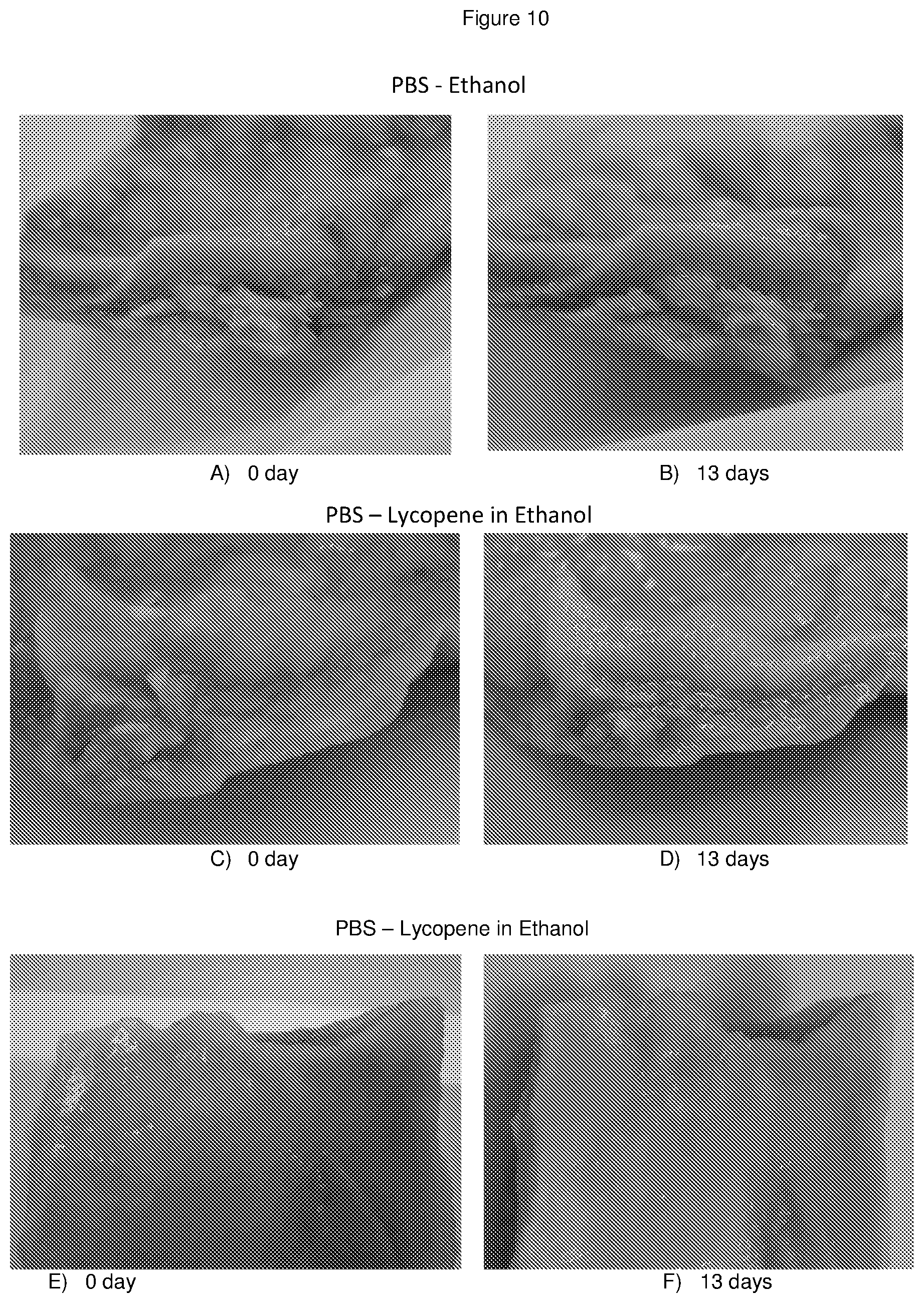 Patent US11779546 Figure 9 – Disassembly of cholesterol crystals