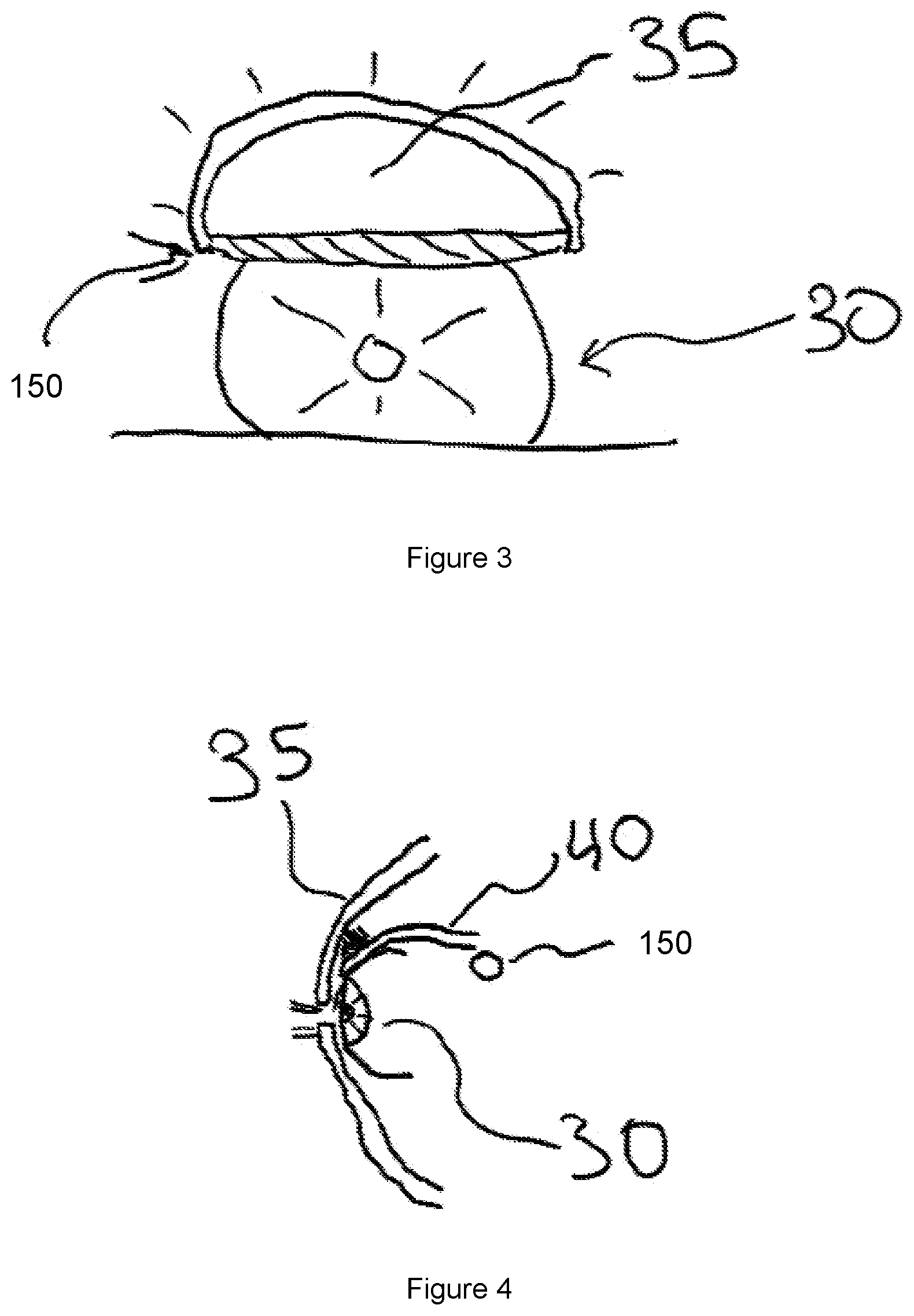 Patent US11779553 Figure 3 – Methods and devices for treatment of eyelid ptosis