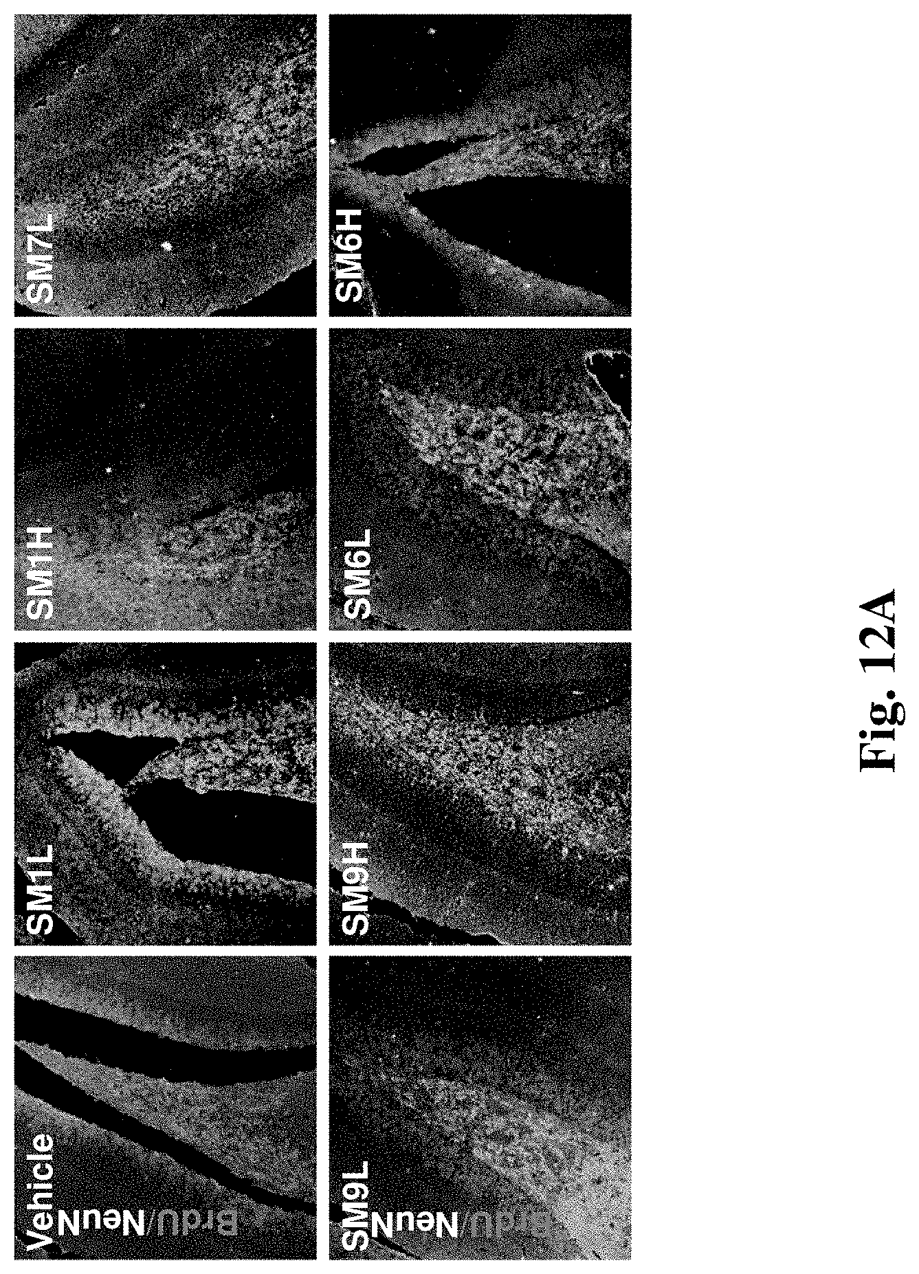 Patent US11779565 Figure 15 – Small organic molecules for use in the treatment of neuroinflammatory disorders