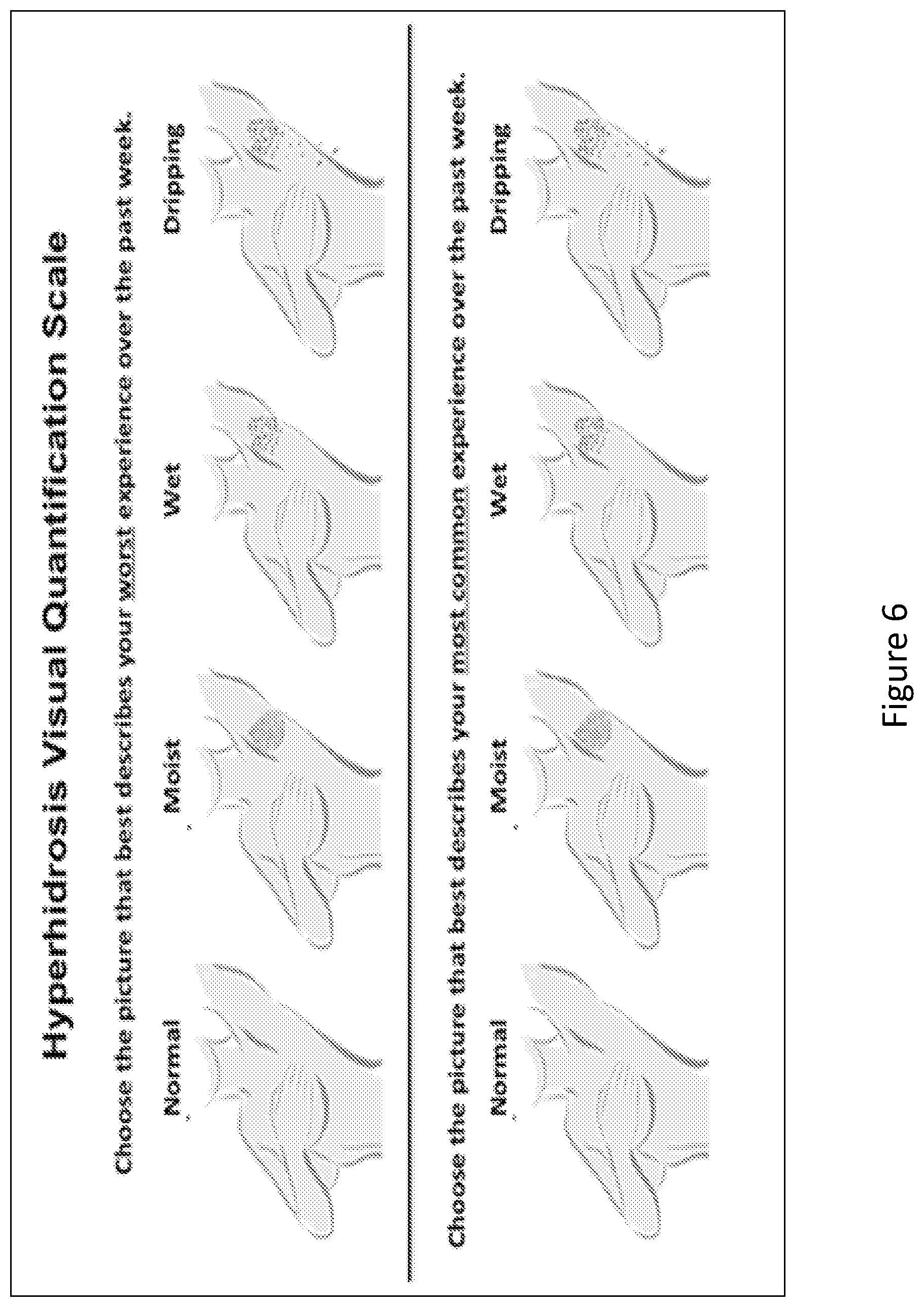 Patent US11779569 Figure 6 – Methods and compositions for treating hyperhidrosis