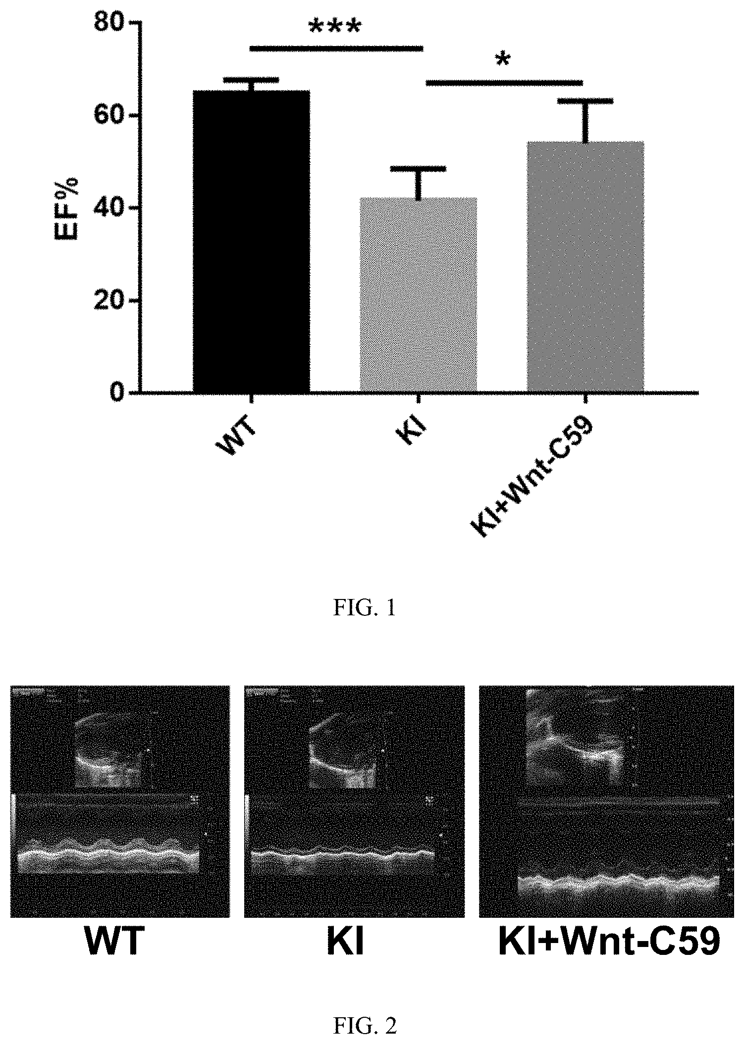 Patent US11779575 Figure 1 – Use of Wnt inhibitor Wnt-C59 in preparation of drug for treating SCN5A mutation-induced dilated cardiomyopathy