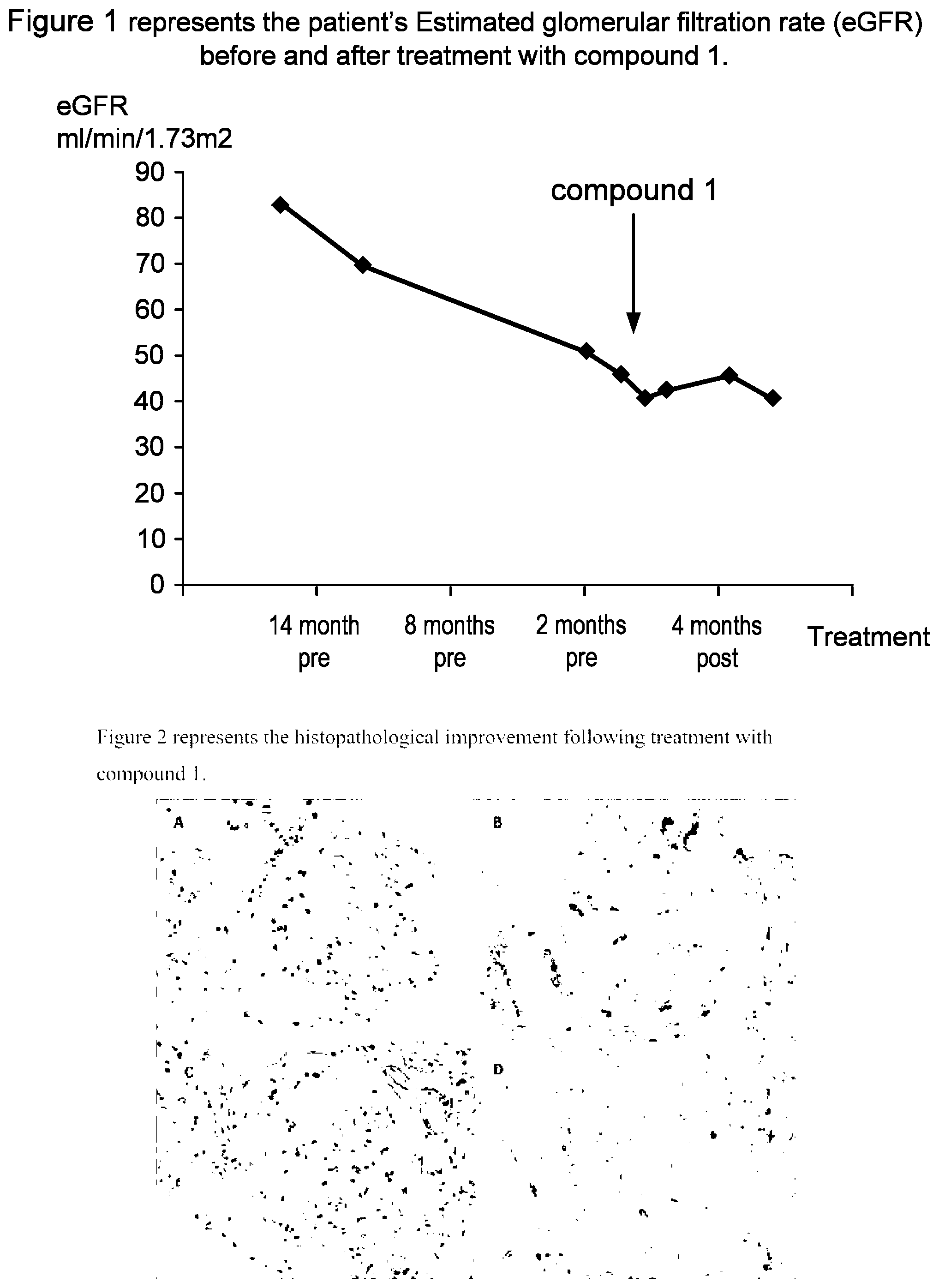 Patent US11779576 Figure 1 – Method of treating C3 glomerulopathy