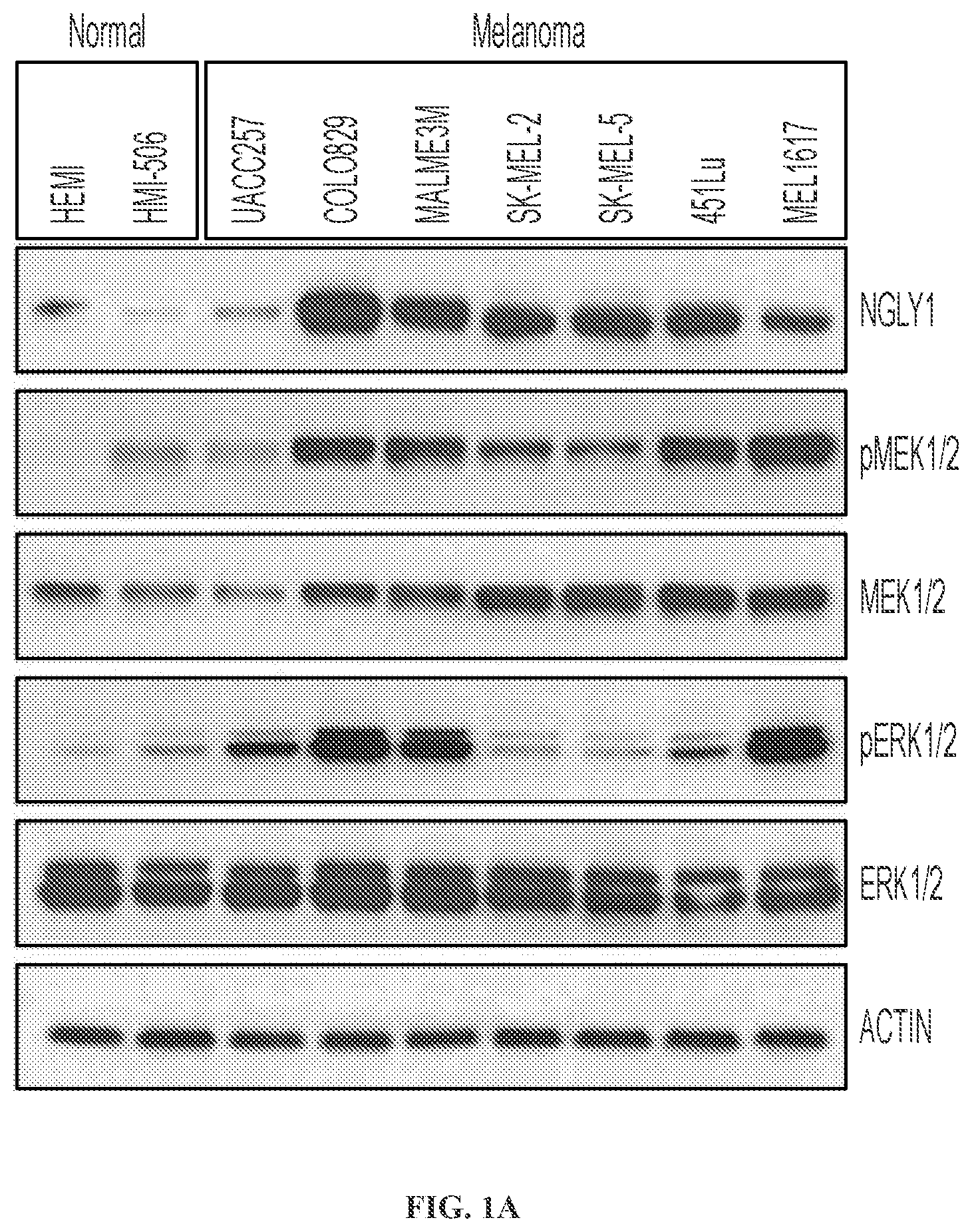 Patent US11779592 Figure 1 – Inhibition of NGLY1 for the treatment of cancer
