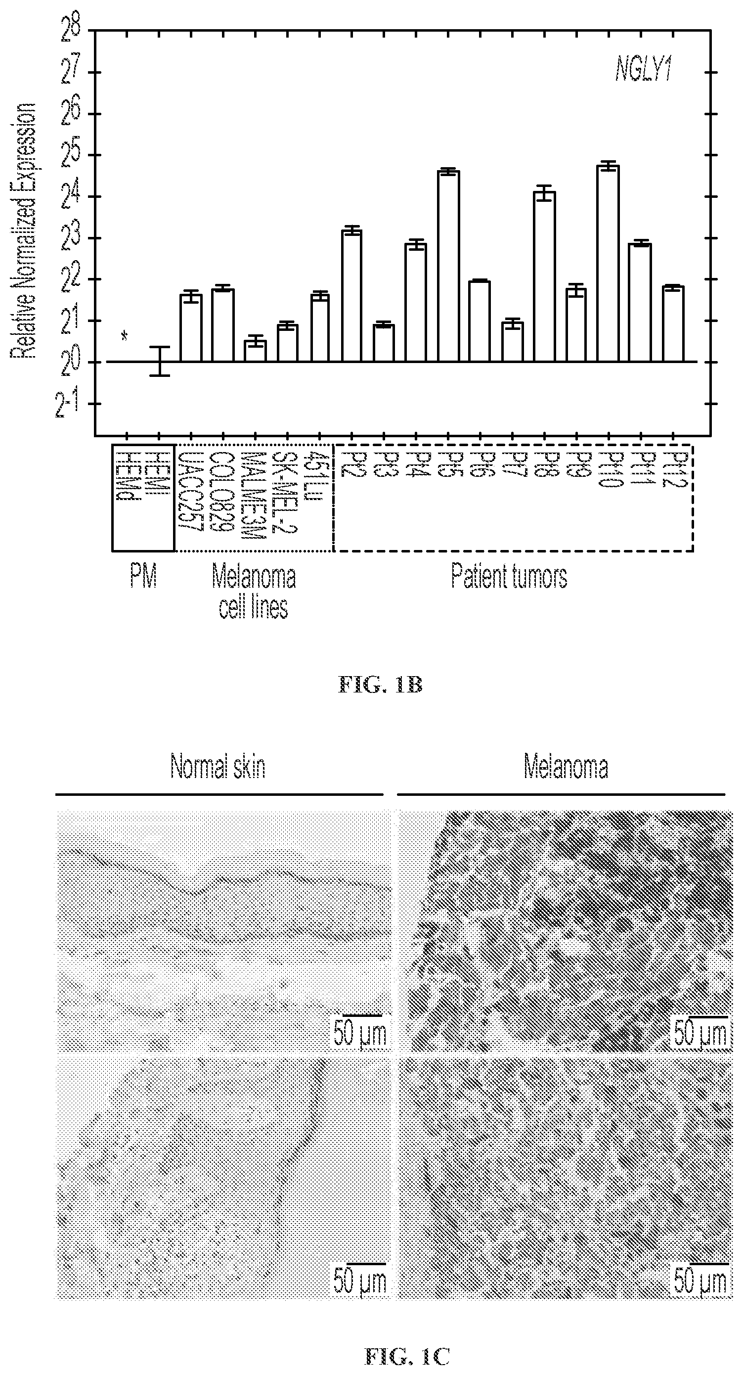 Patent US11779592 Figure 2 – Inhibition of NGLY1 for the treatment of cancer