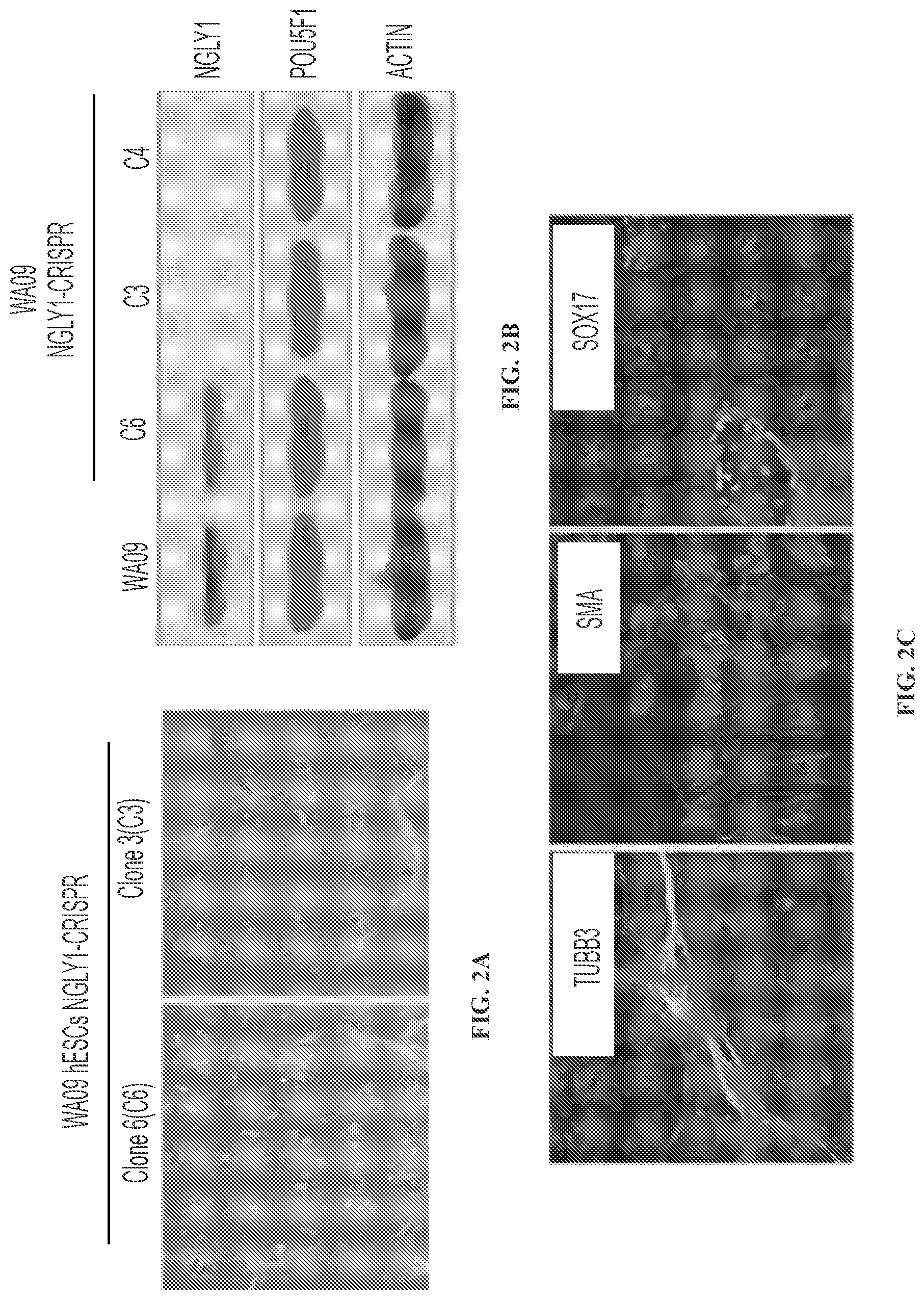 Patent US11779592 Figure 3 – Inhibition of NGLY1 for the treatment of cancer