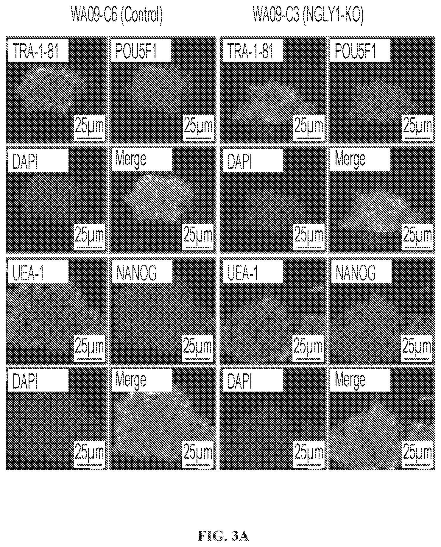 Patent US11779592 Figure 4 – Inhibition of NGLY1 for the treatment of cancer