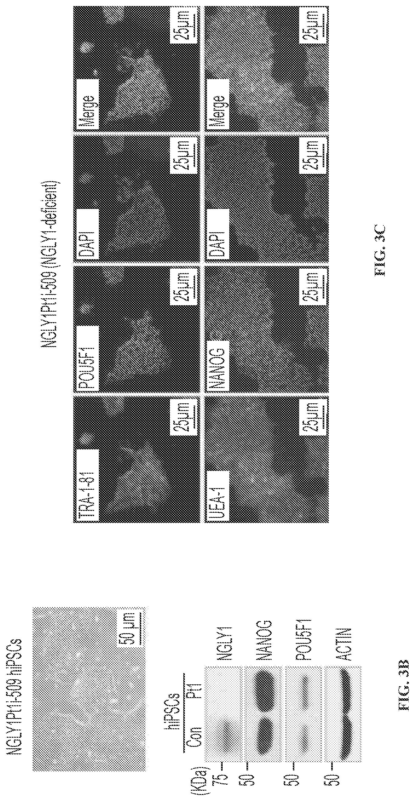 Patent US11779592 Figure 5 – Inhibition of NGLY1 for the treatment of cancer